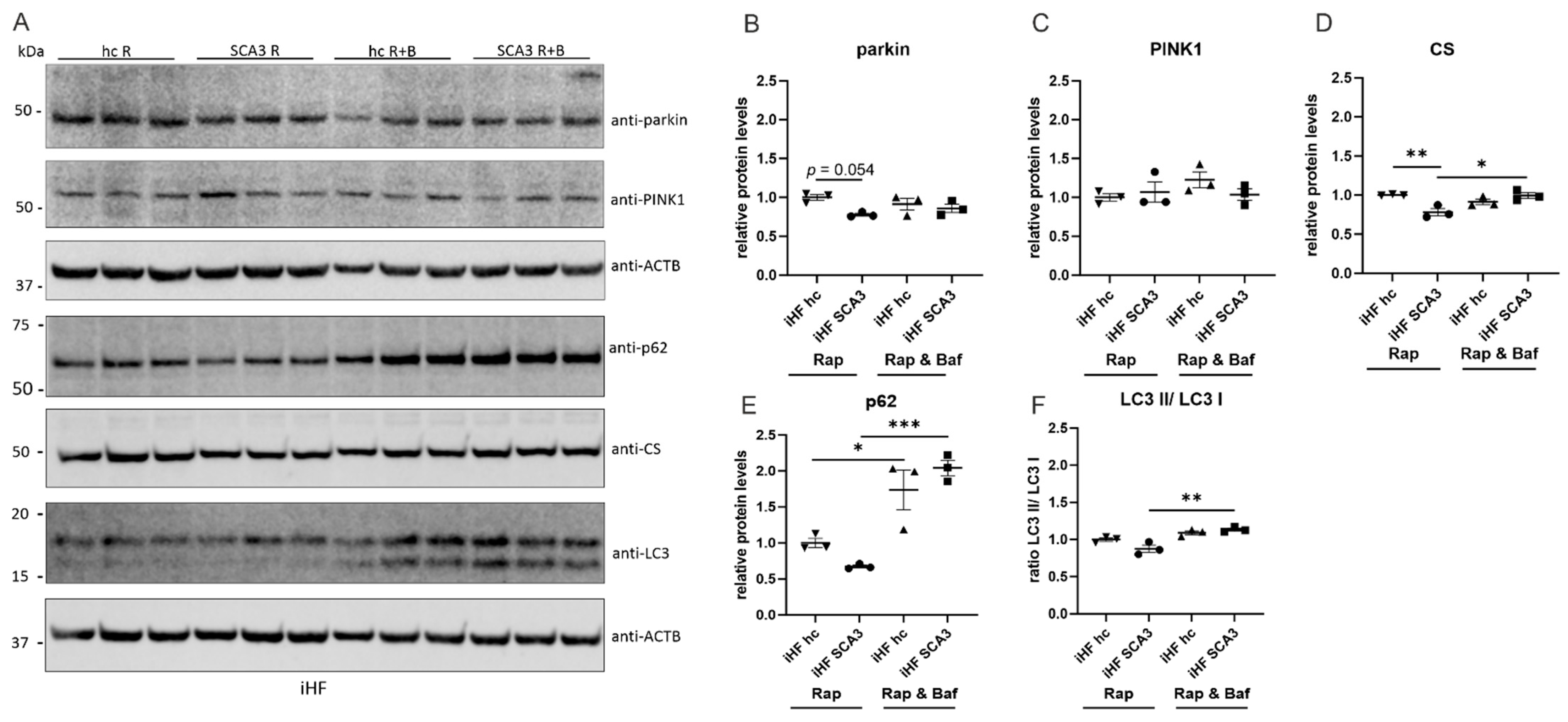 Ataxina-3 e a disputa entre a reciclagem mitocondrial e a morte