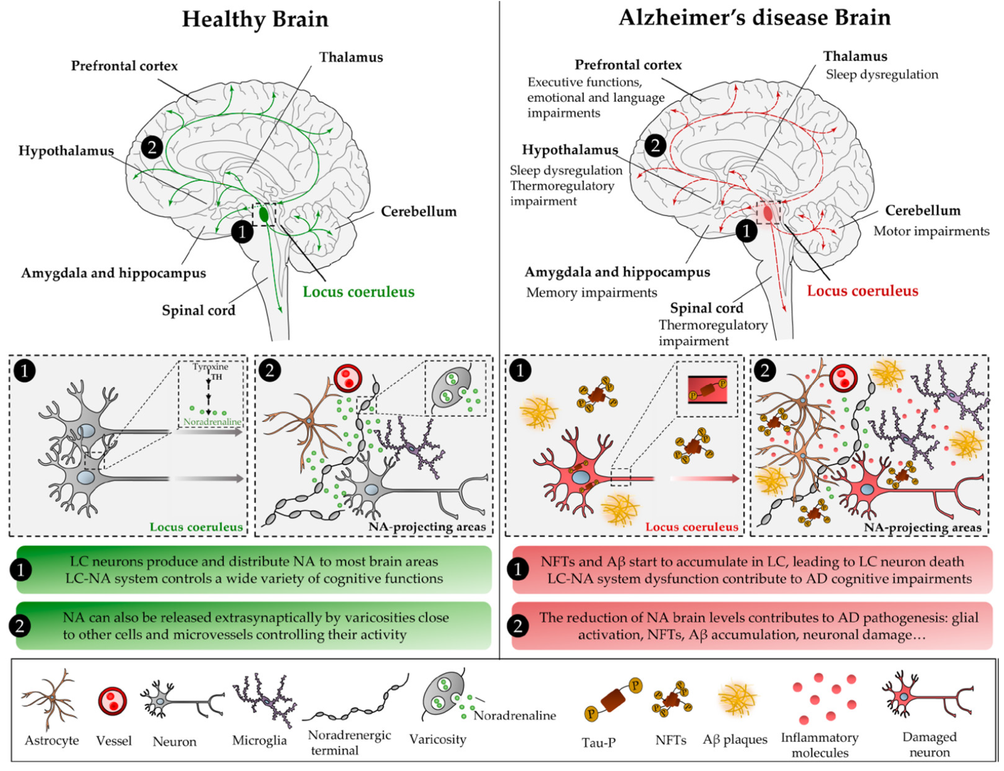IJMS | Free Full-Text | Noradrenaline in Alzheimer&rsquo;s Disease: A New  Potential Therapeutic Target