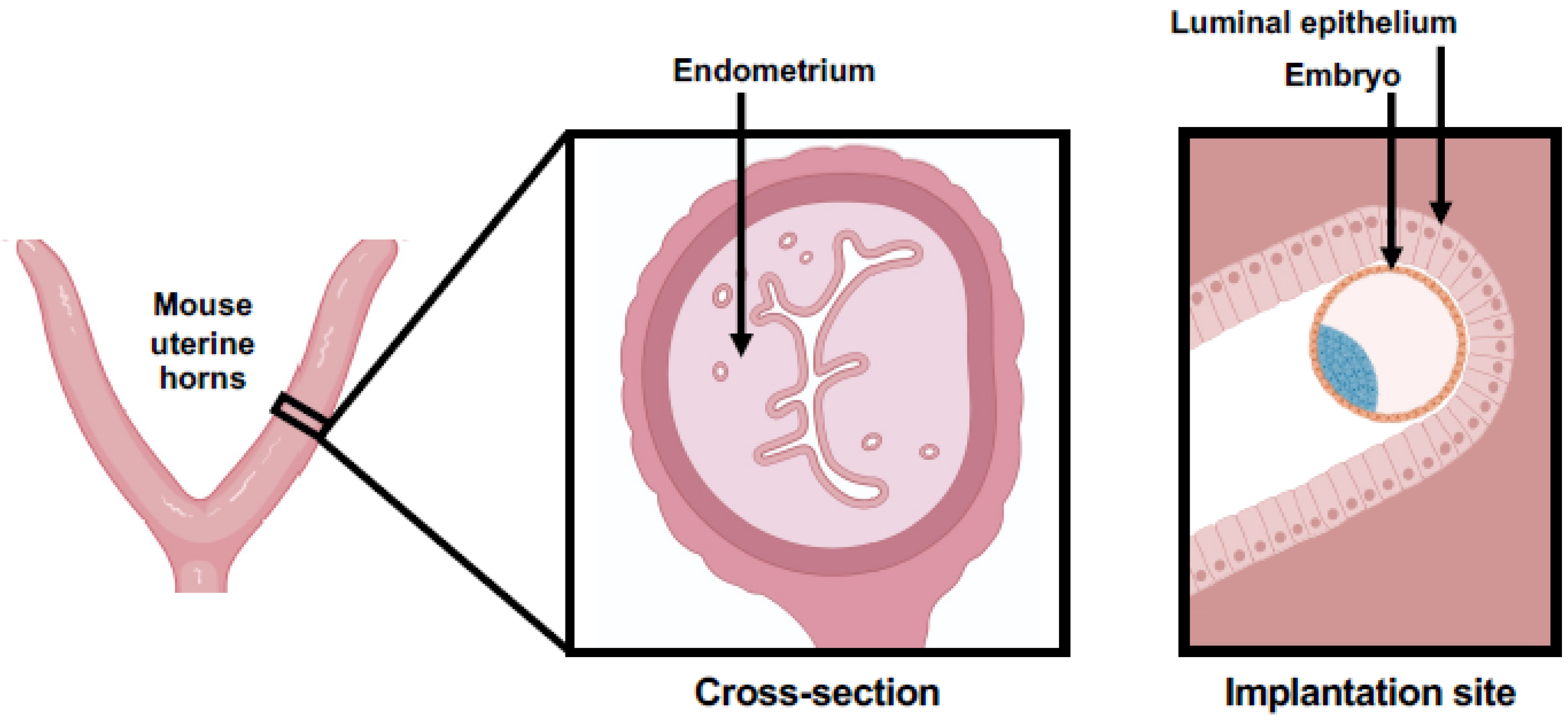 implantation of embryo in uterus