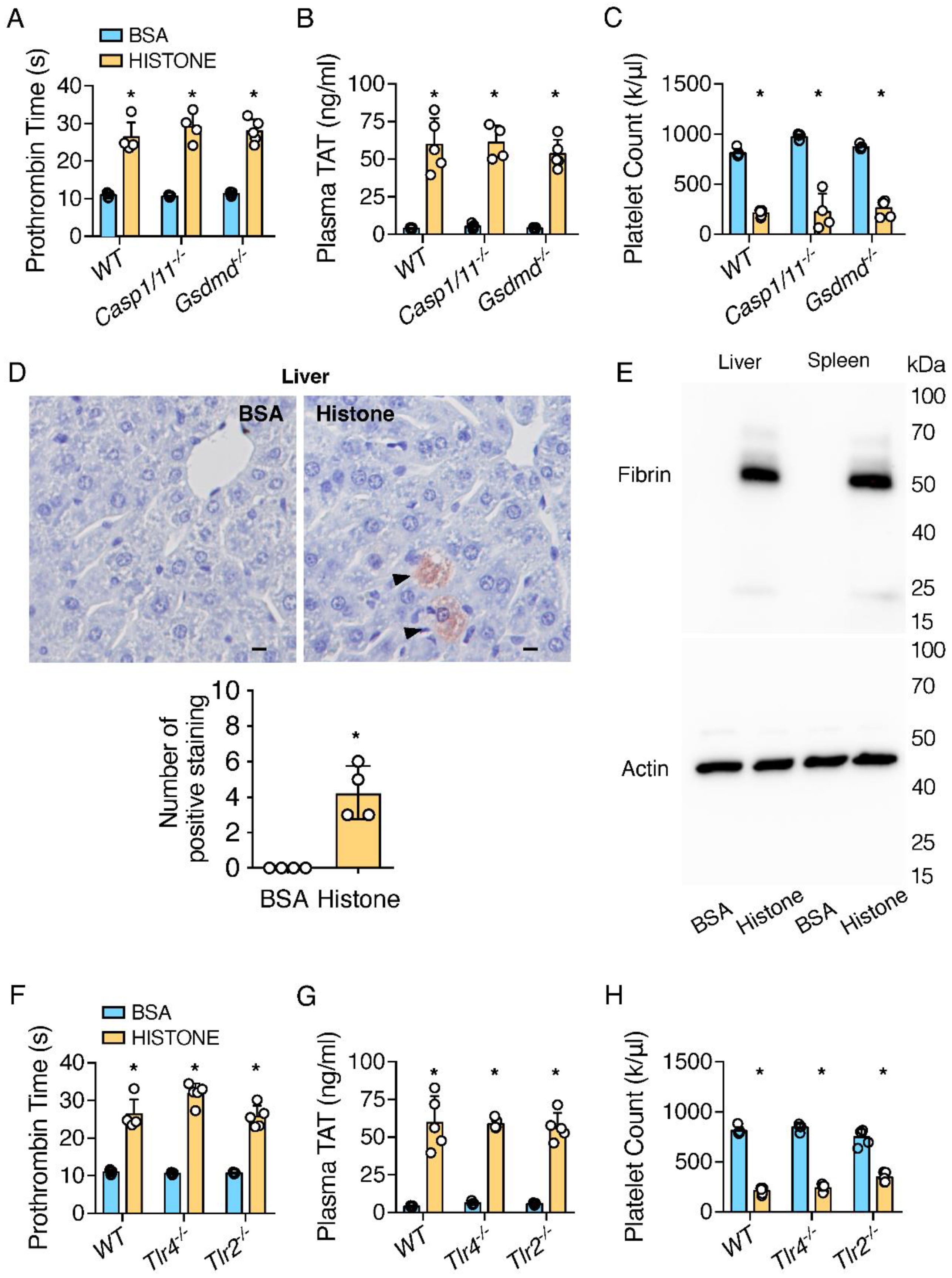 IJMS Free Full Text Extracellular Histones Trigger