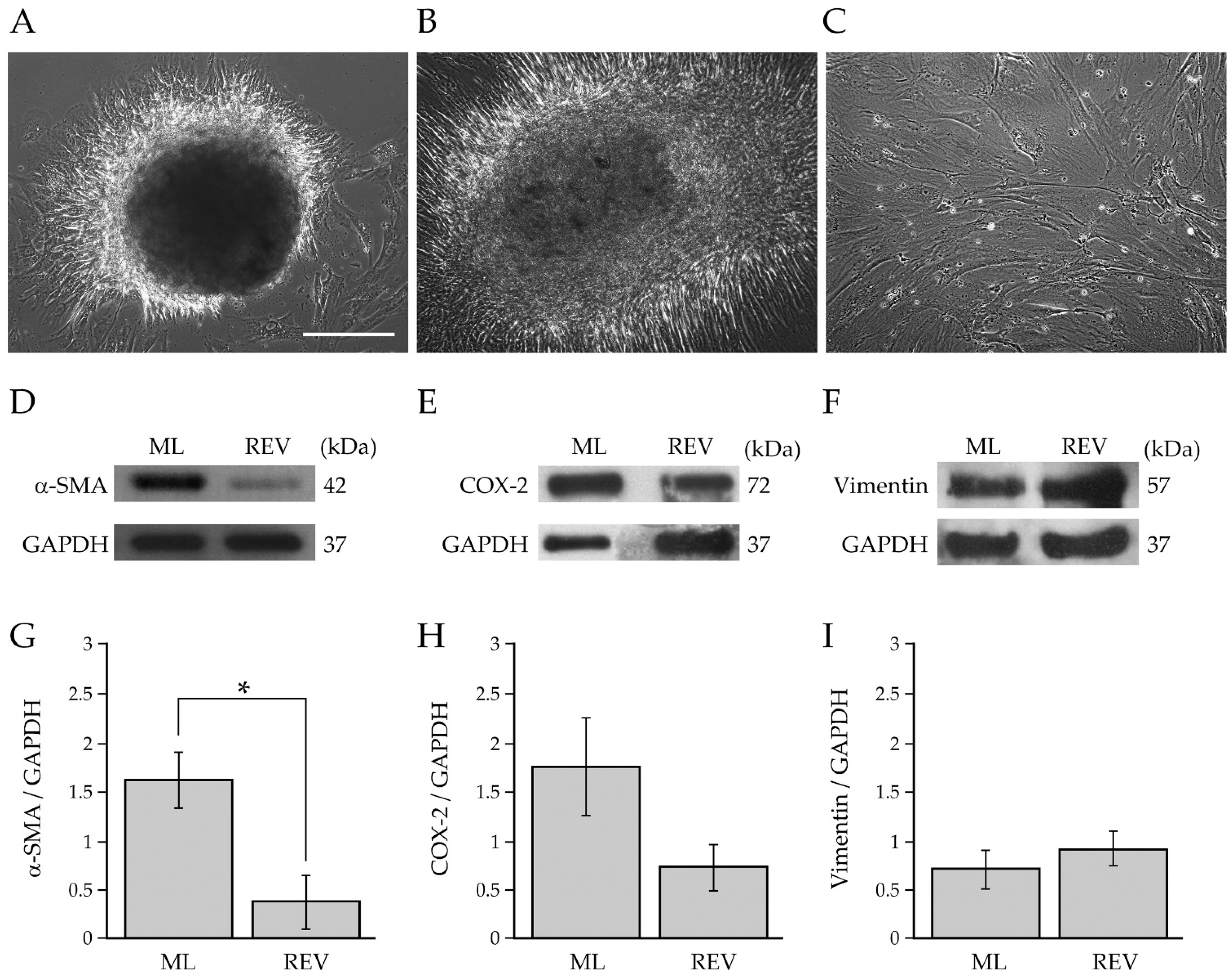 Ijms Free Full Text Generation And Characterization Of A Tumor Stromal Microenvironment And Analysis Of Its Interplay With Breast Cancer Cells An In Vitro Model To Study Breast Cancer Associated Fibroblast Inactivation