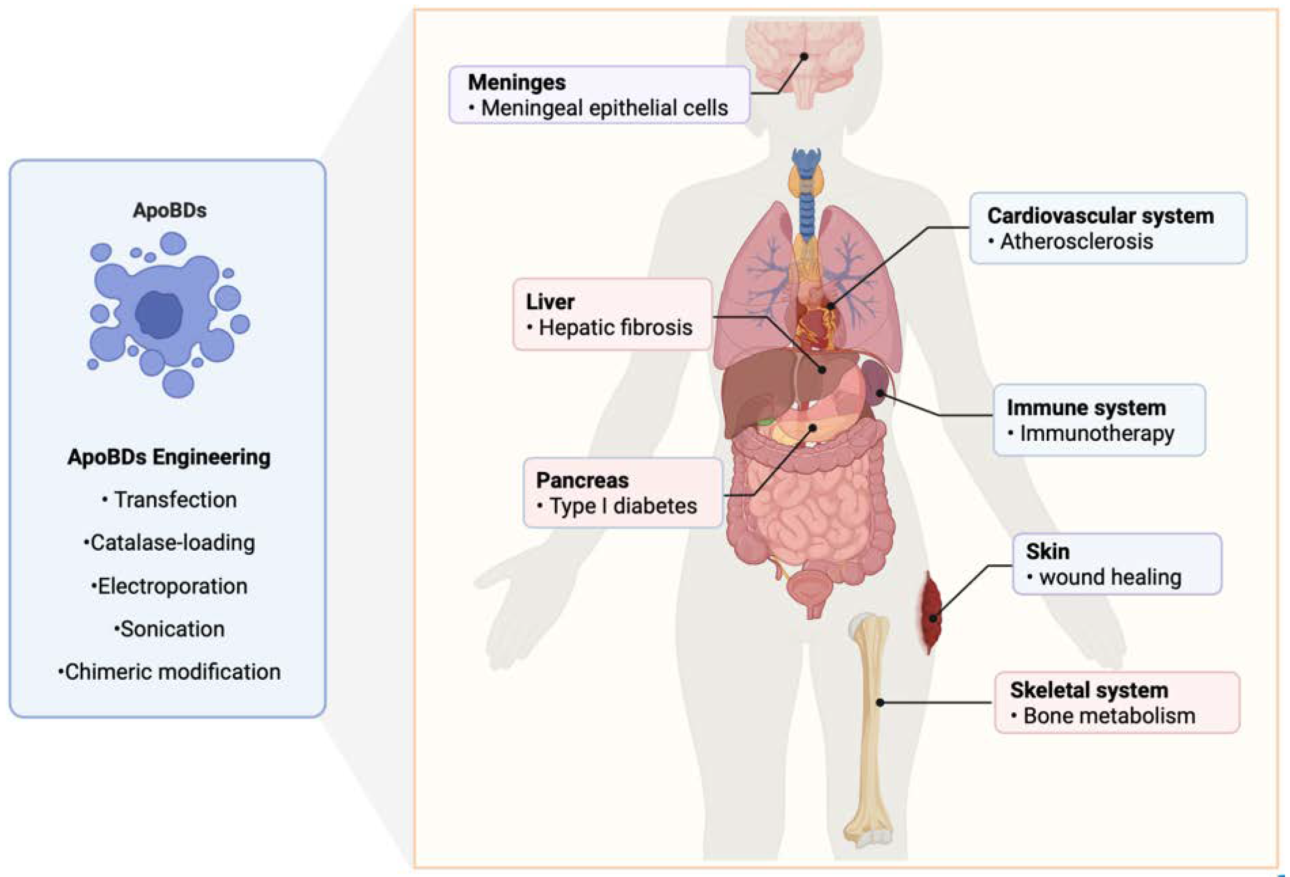 Advances in the Therapeutic Effects of Apoptotic Bodies on Systemic ...