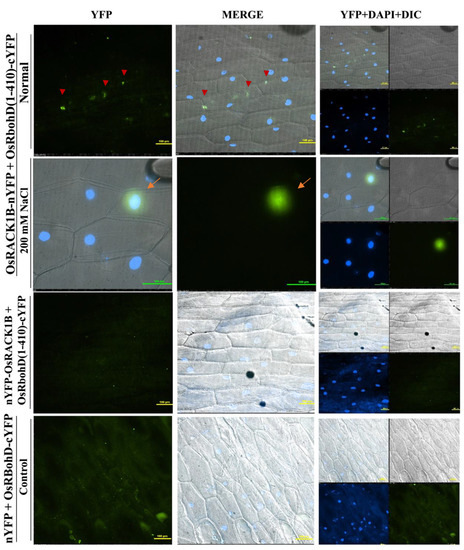 IJMS | Free Full-Text | Receptor For Activated C Kinase1B (OsRACK1B ...