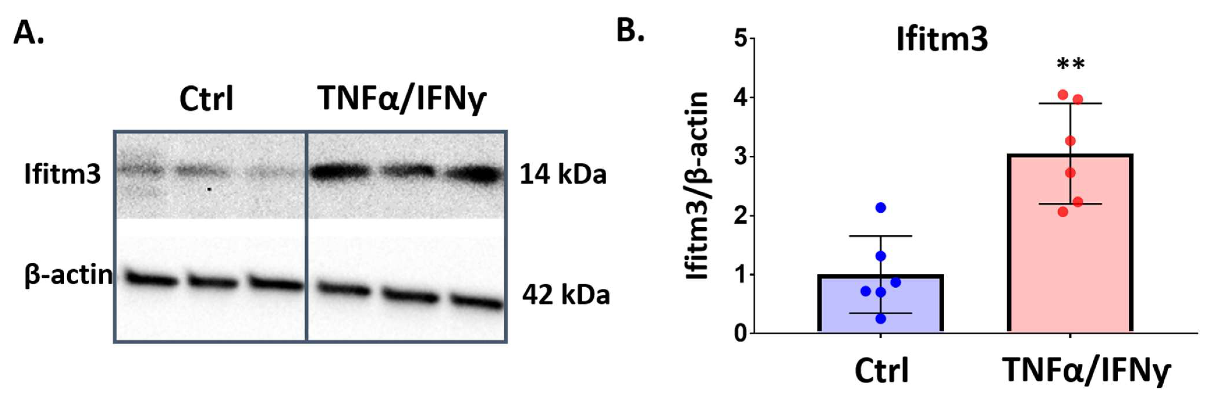 IJMS | Free Full-Text | Increased Expression Of Interferon-Induced ...