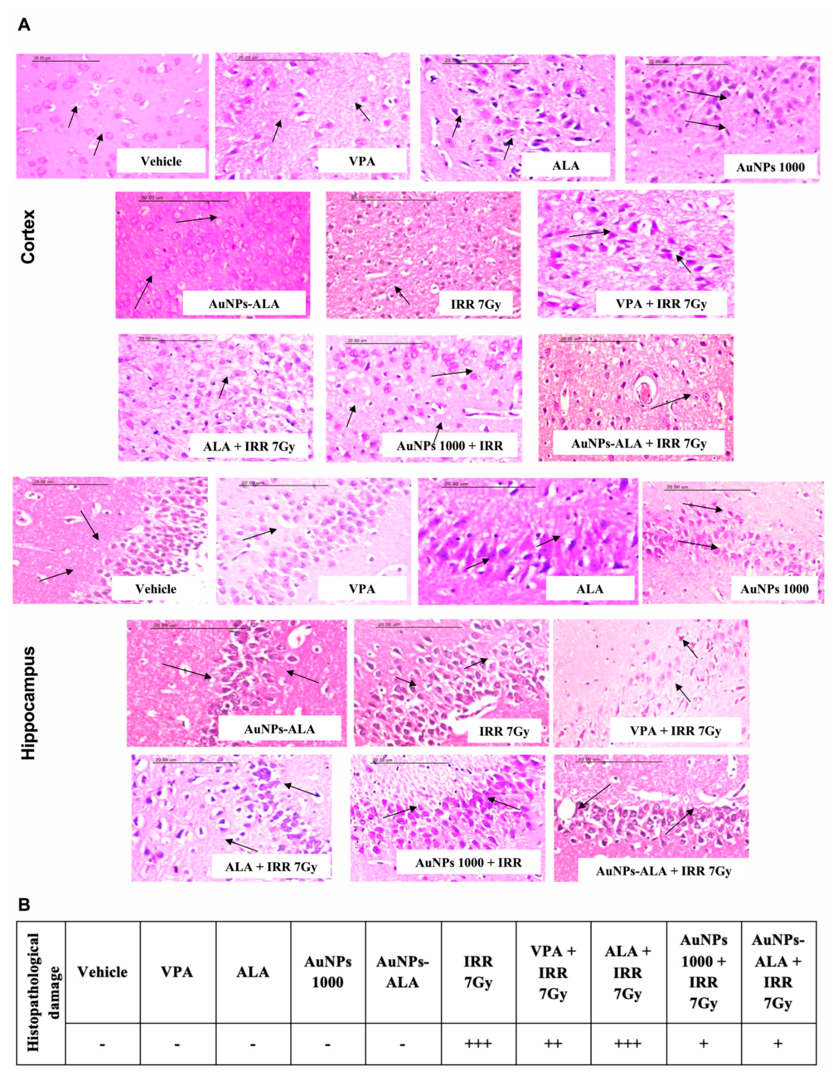 Ijms 23 09640 g011 Ijms 23 09640 g011