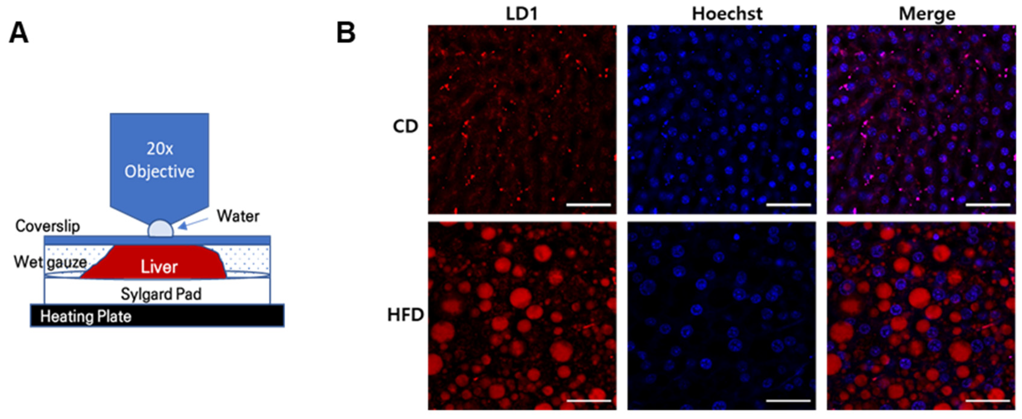 IJMS | Free Full-Text | In Vivo Two-Photon Imaging Analysis of Dynamic  Degradation of Hepatic Lipid Droplets in MS-275-Treated Mouse Liver