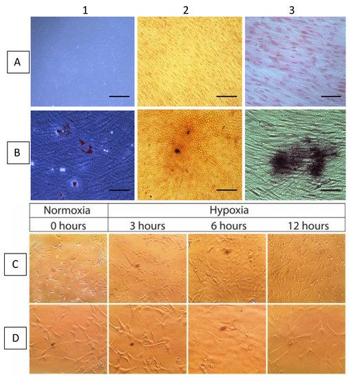 MicroRNA-30e-5p has an Integrated Role in the Regulation of the