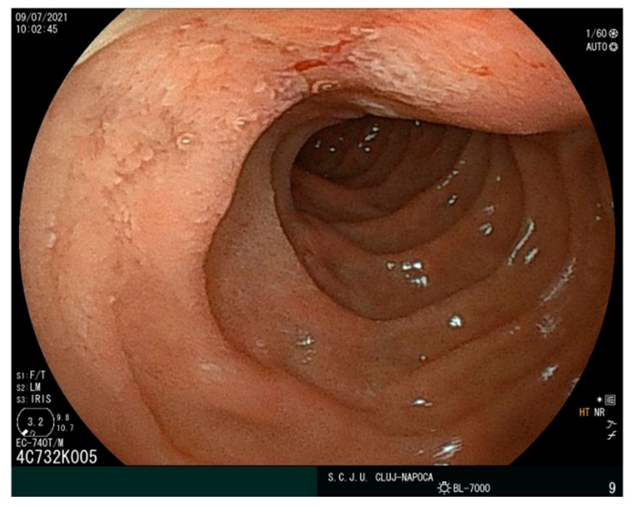 Ijms 23 10351 g003 Ijms 23 10351 g003