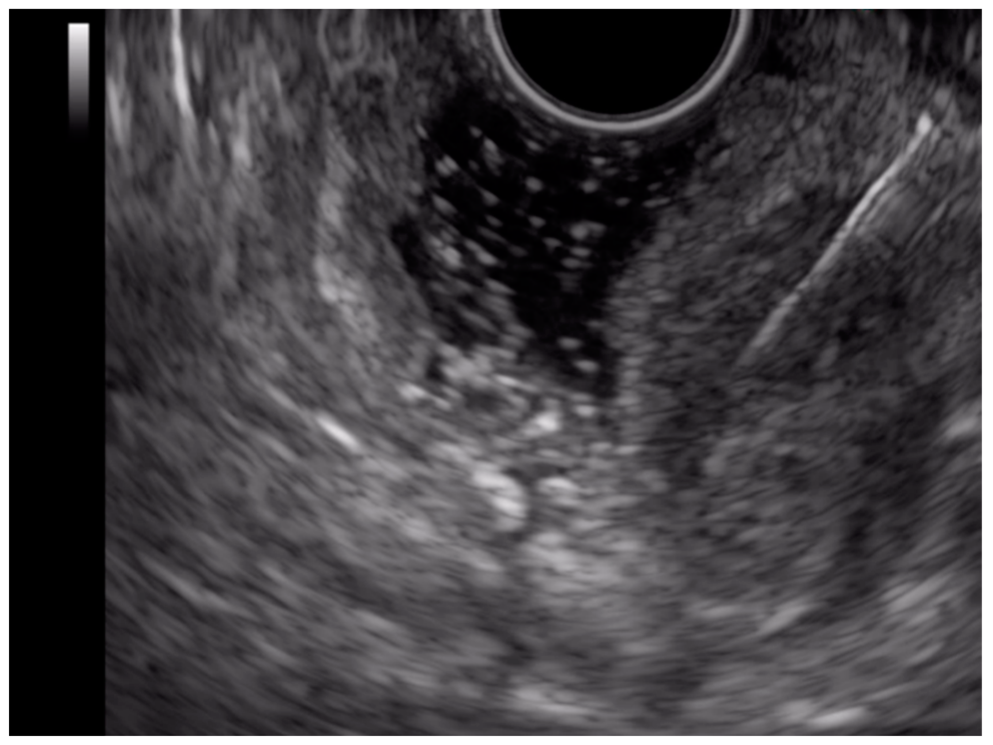 Ijms 23 10351 g005 Ijms 23 10351 g005