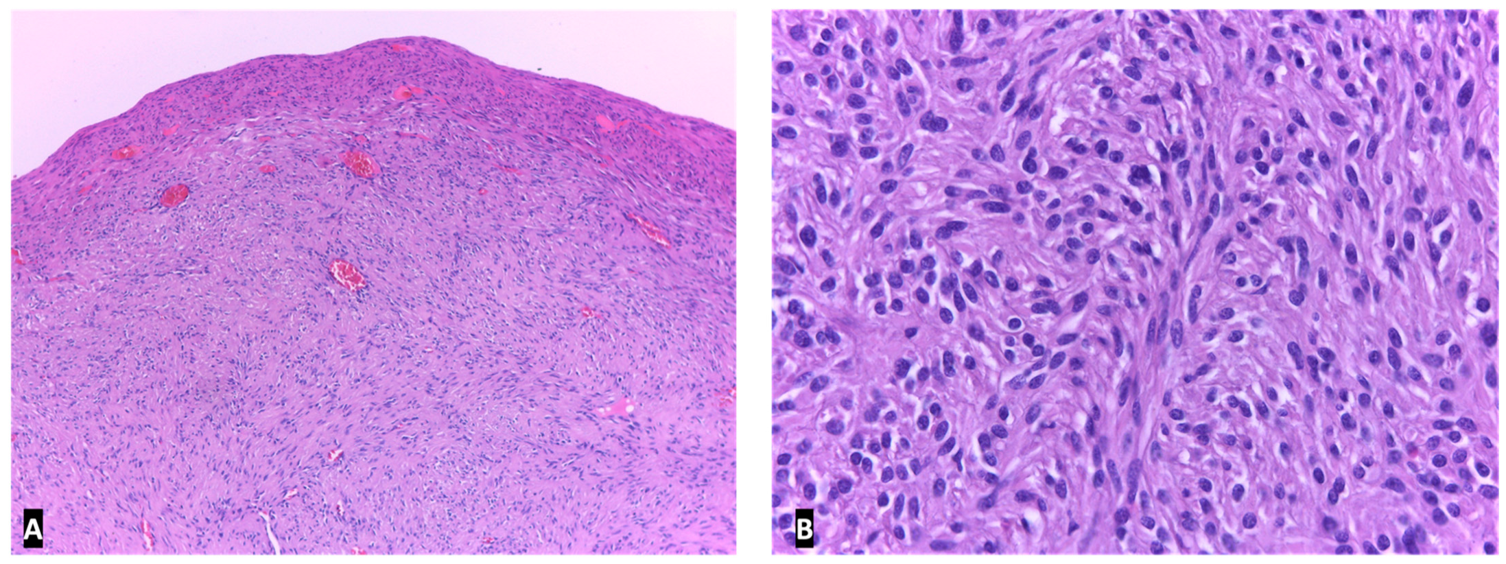 Ijms 23 10351 g011 Ijms 23 10351 g011