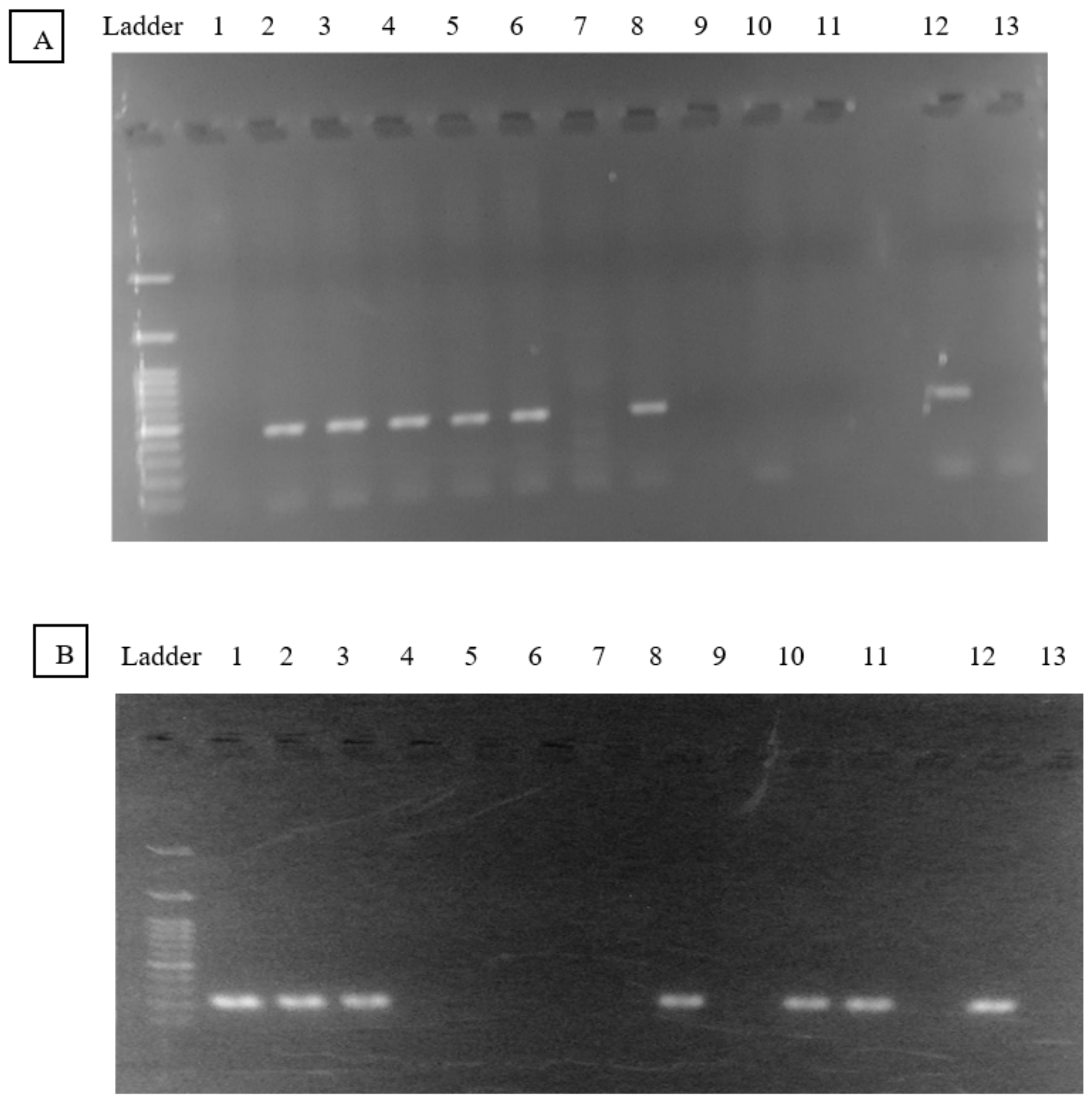 PDF) NAT2 Acetylators Gene Polymorphisms in Peruvian Populations