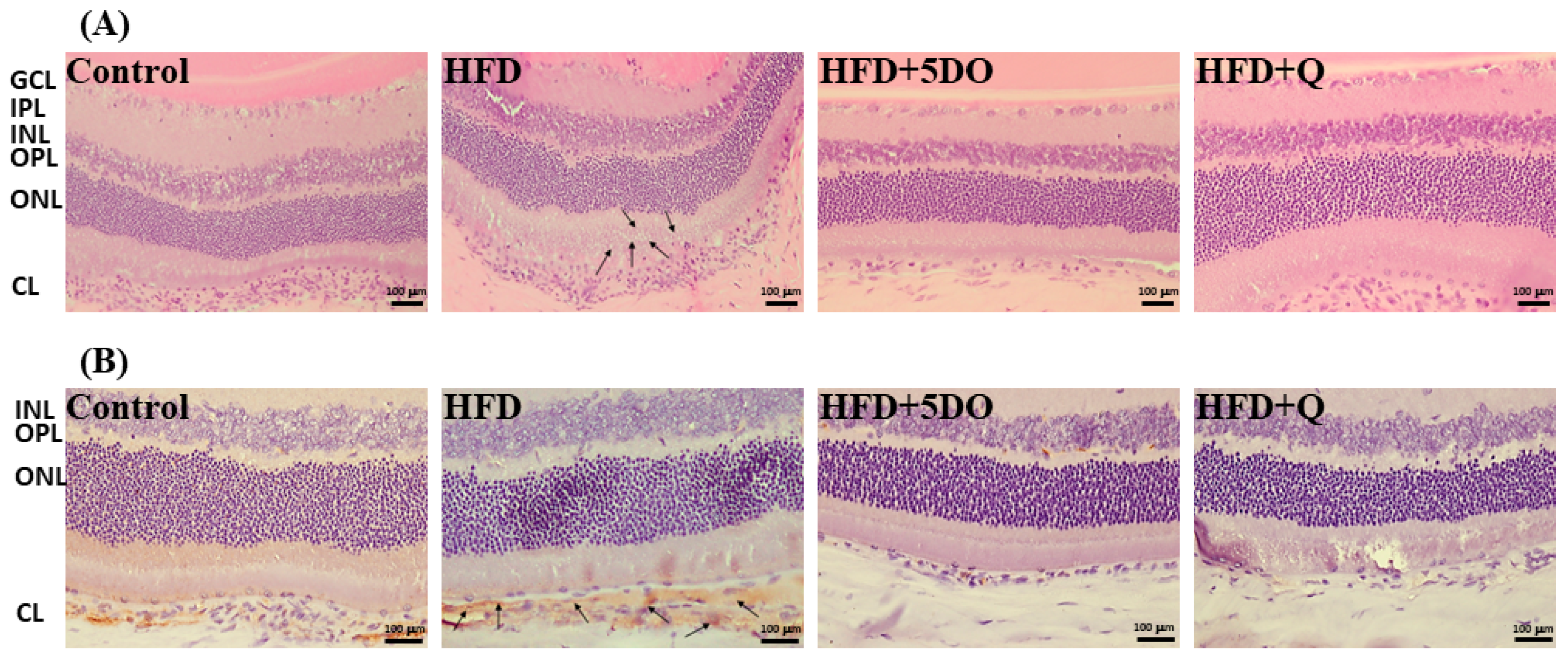 IJMS | Free Full-Text | Effects of Dried Onion Powder and Quercetin on  Obesity-Associated Hepatic Menifestation and Retinopathy