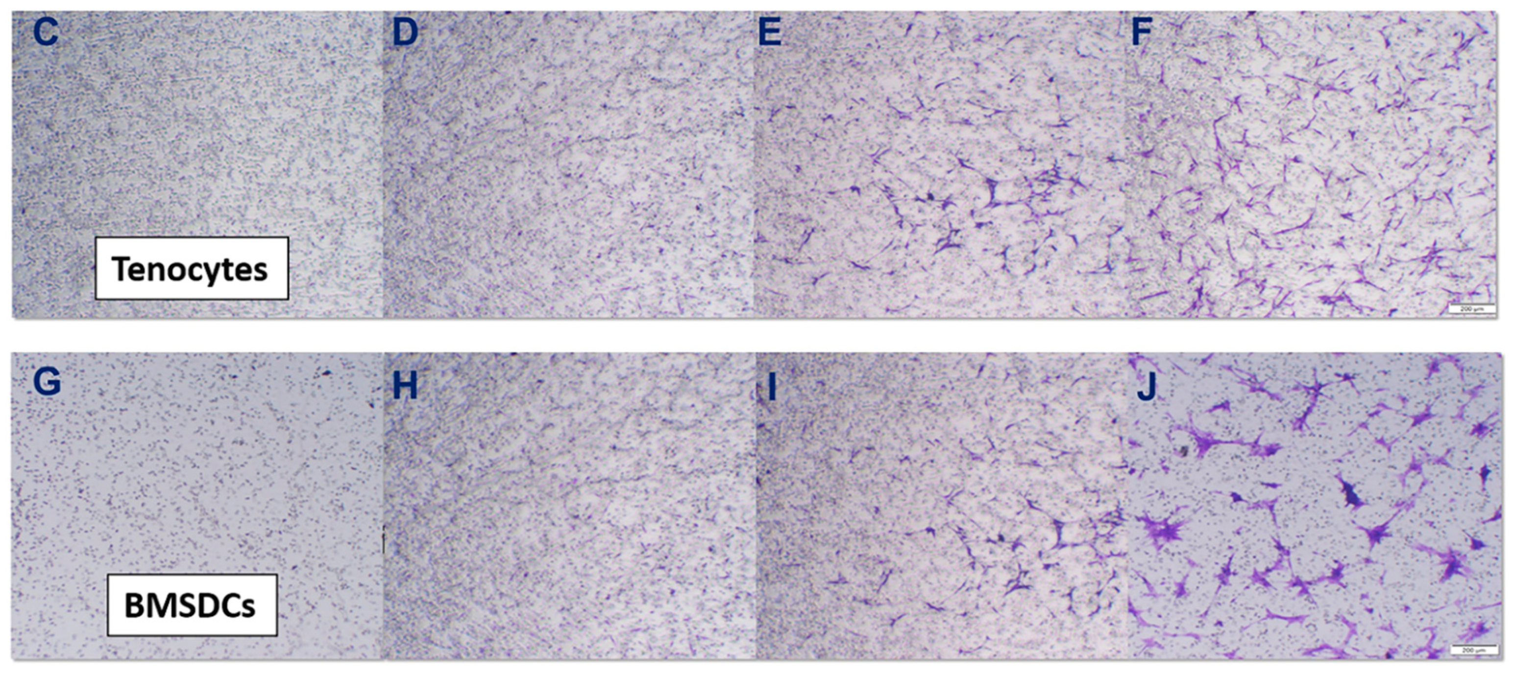 Overview - Tendon and Soft Tissue Biology: Peter C. Amadio - Mayo Clinic  Research