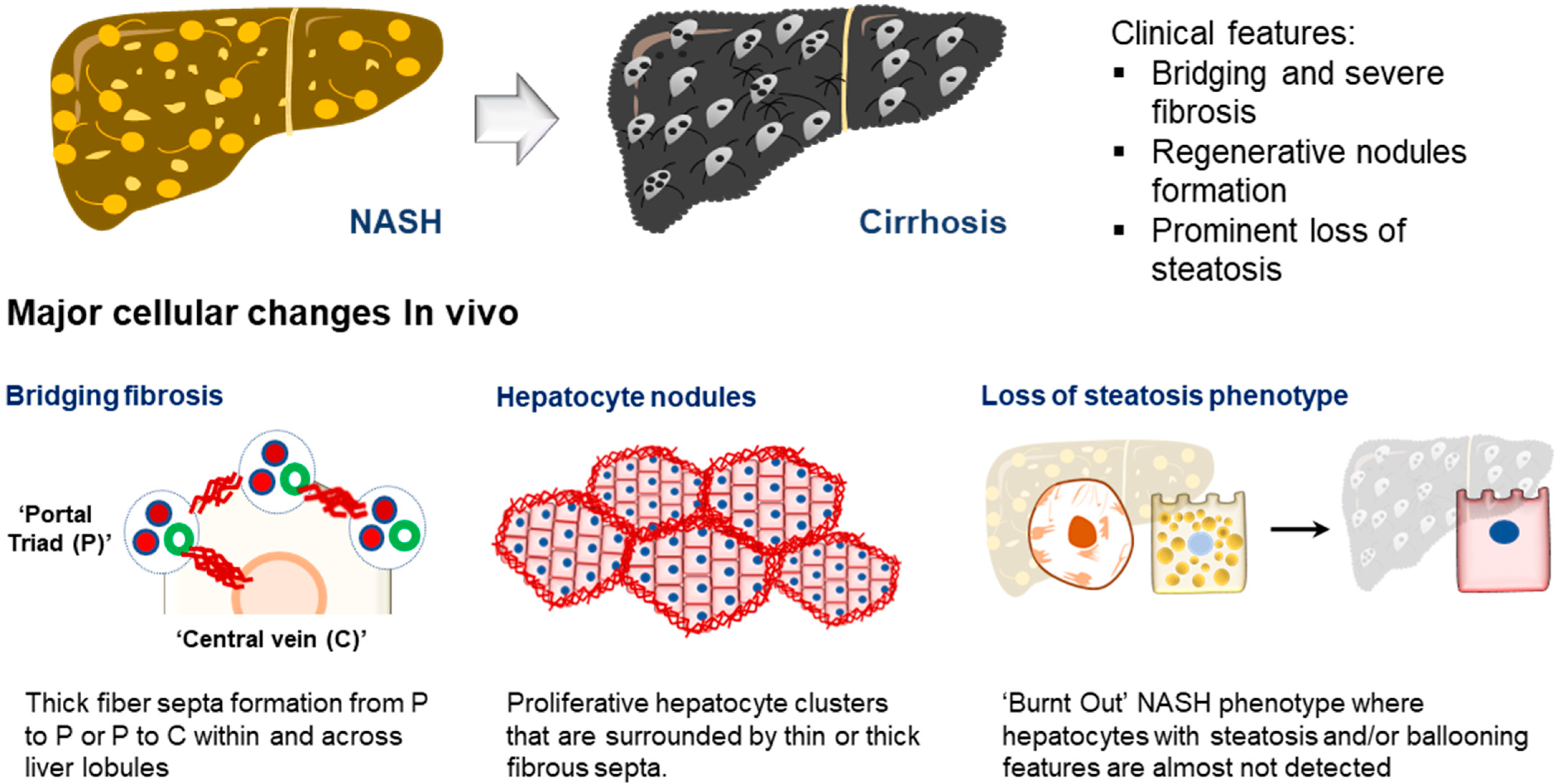 A 3D primary human cell-based in vitro model of non-alcoholic  steatohepatitis for efficacy testing of clinical drug candidates