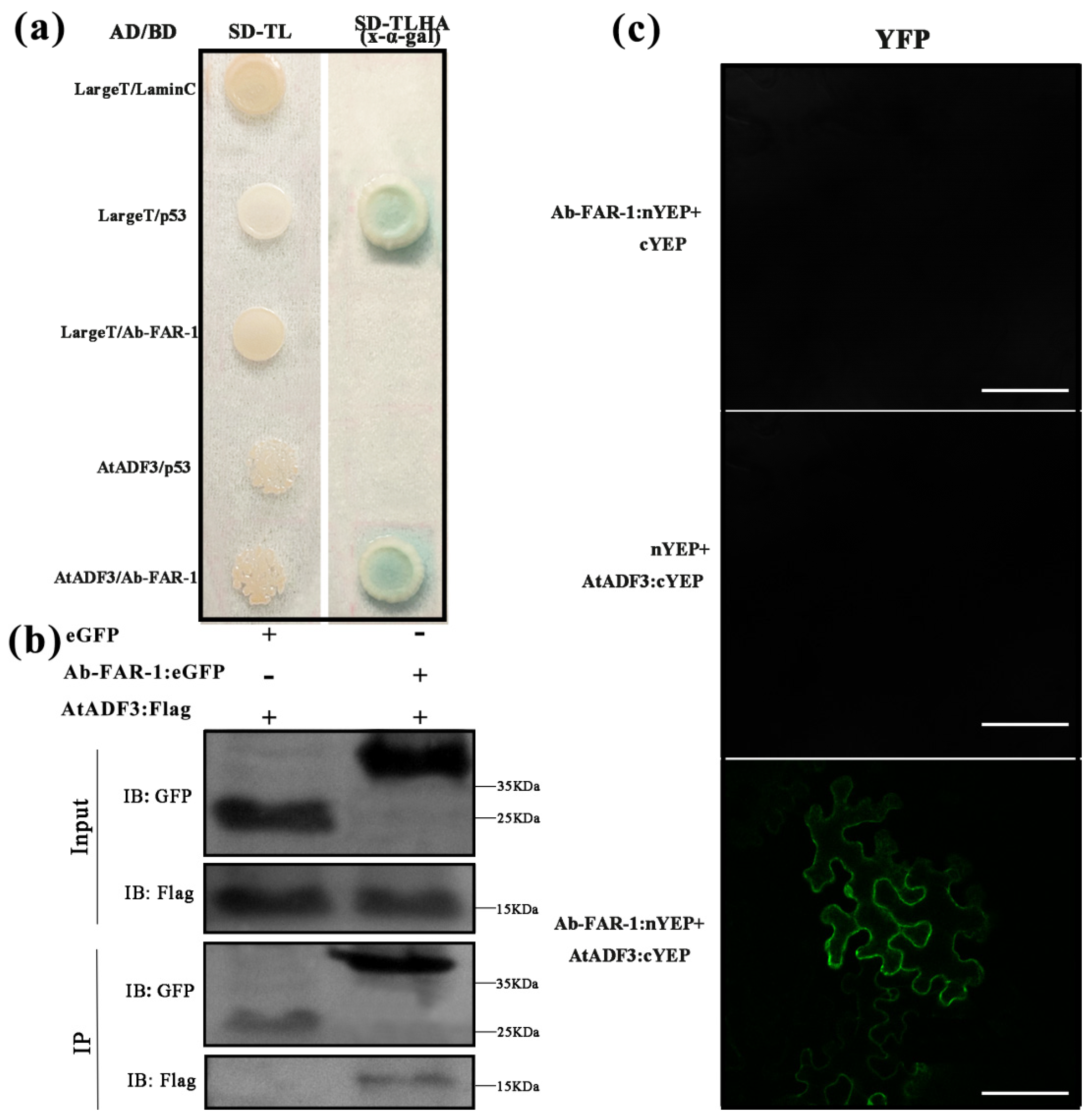 IJMS | Free Full-Text | Aphelenchoides besseyi Ab-FAR-1 Interacts with  Arabidopsis thaliana AtADF3 to Interfere with Actin Cytoskeleton, and  Promotes Nematode Parasitism and Pathogenicity | HTML