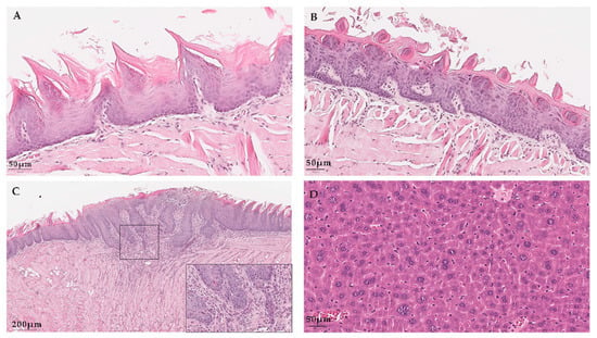 Characterization Of The Human Papillomavirus 16 Oncogenes In K14hpv16 