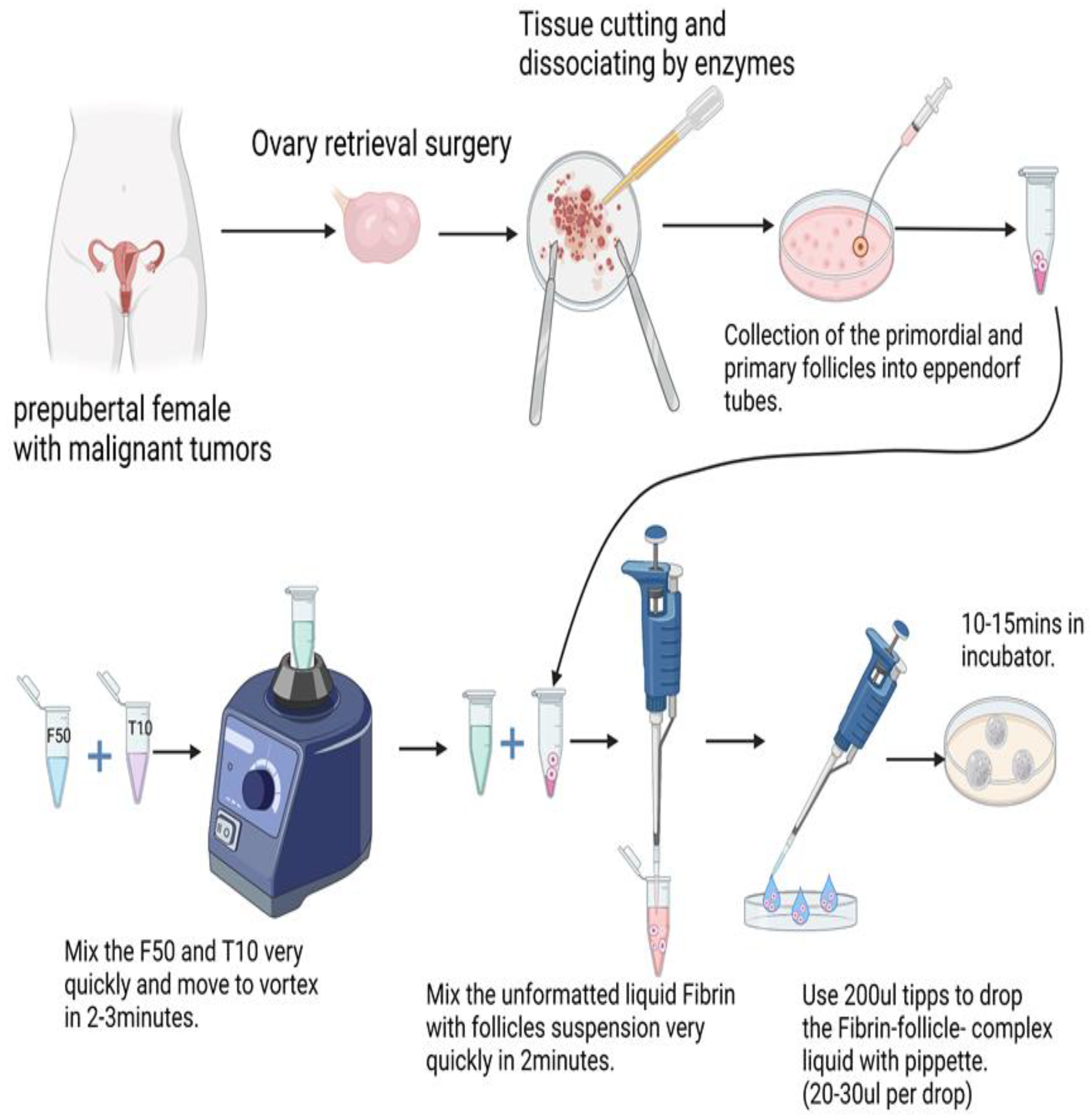 PDF) Ovarian Surgery and Ovarian Reserve: The Application of Temporary  Compression for Natural Hemostasis to Eliminate Exposure of the Ovary to  Chemical Agents and Physical Energies