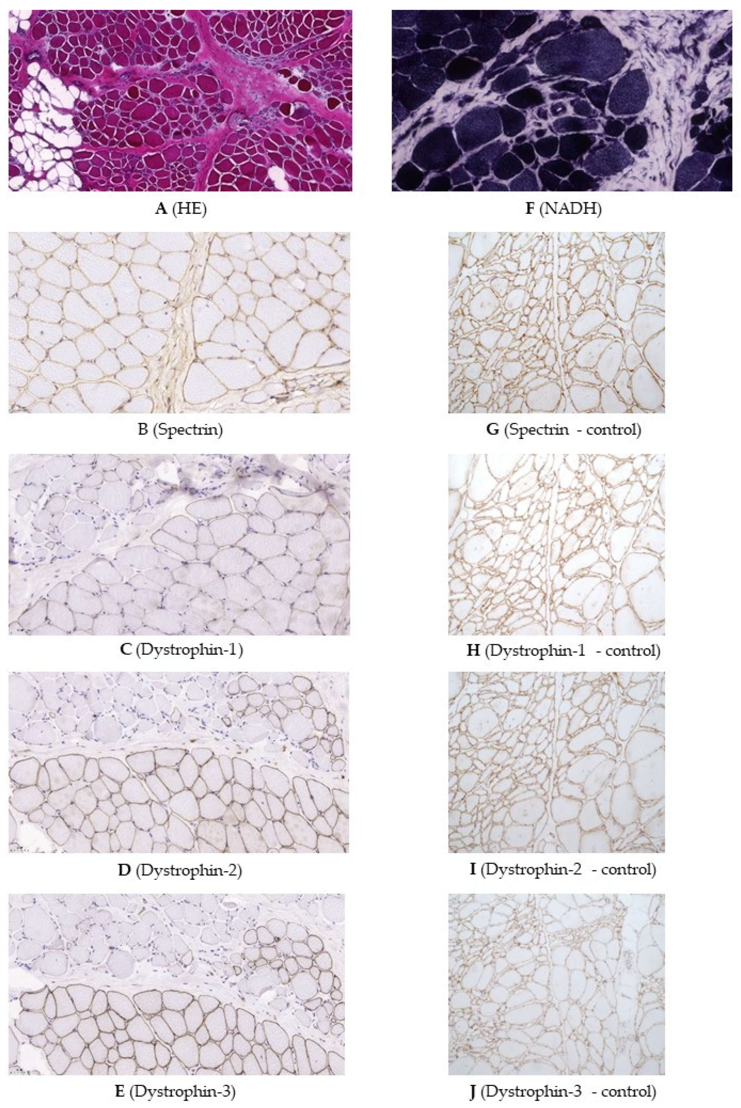 Ijms 23 13076 g002 Ijms 23 13076 g002