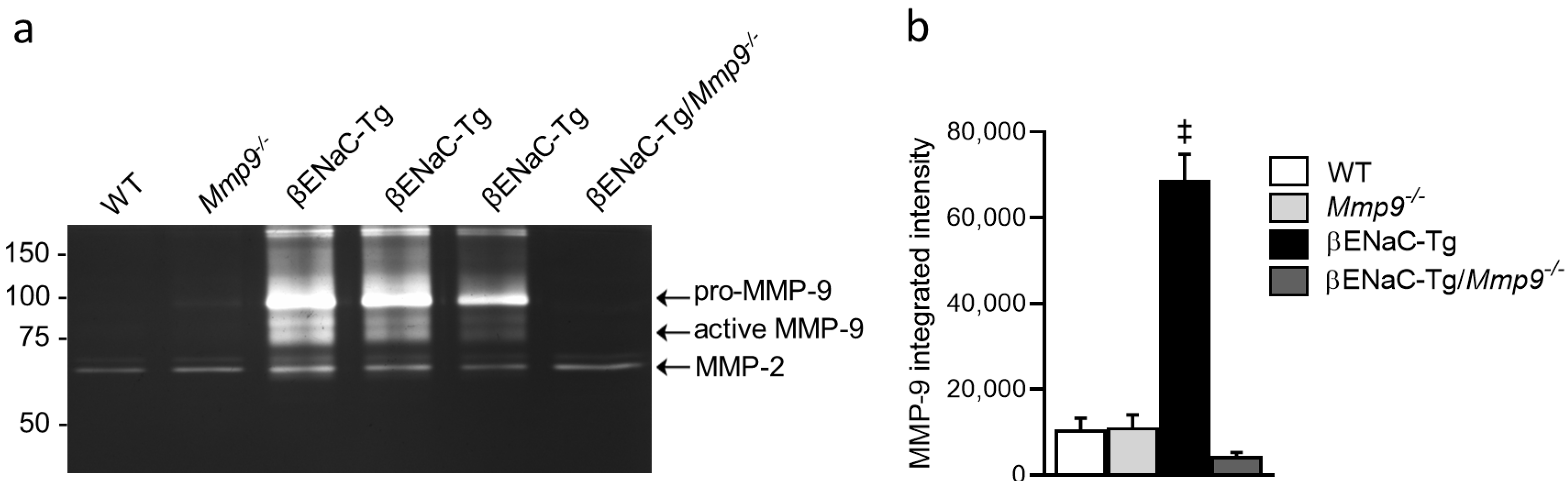 IJMS | Free Full-Text | Genetic Deletion of Mmp9 Does Not Reduce