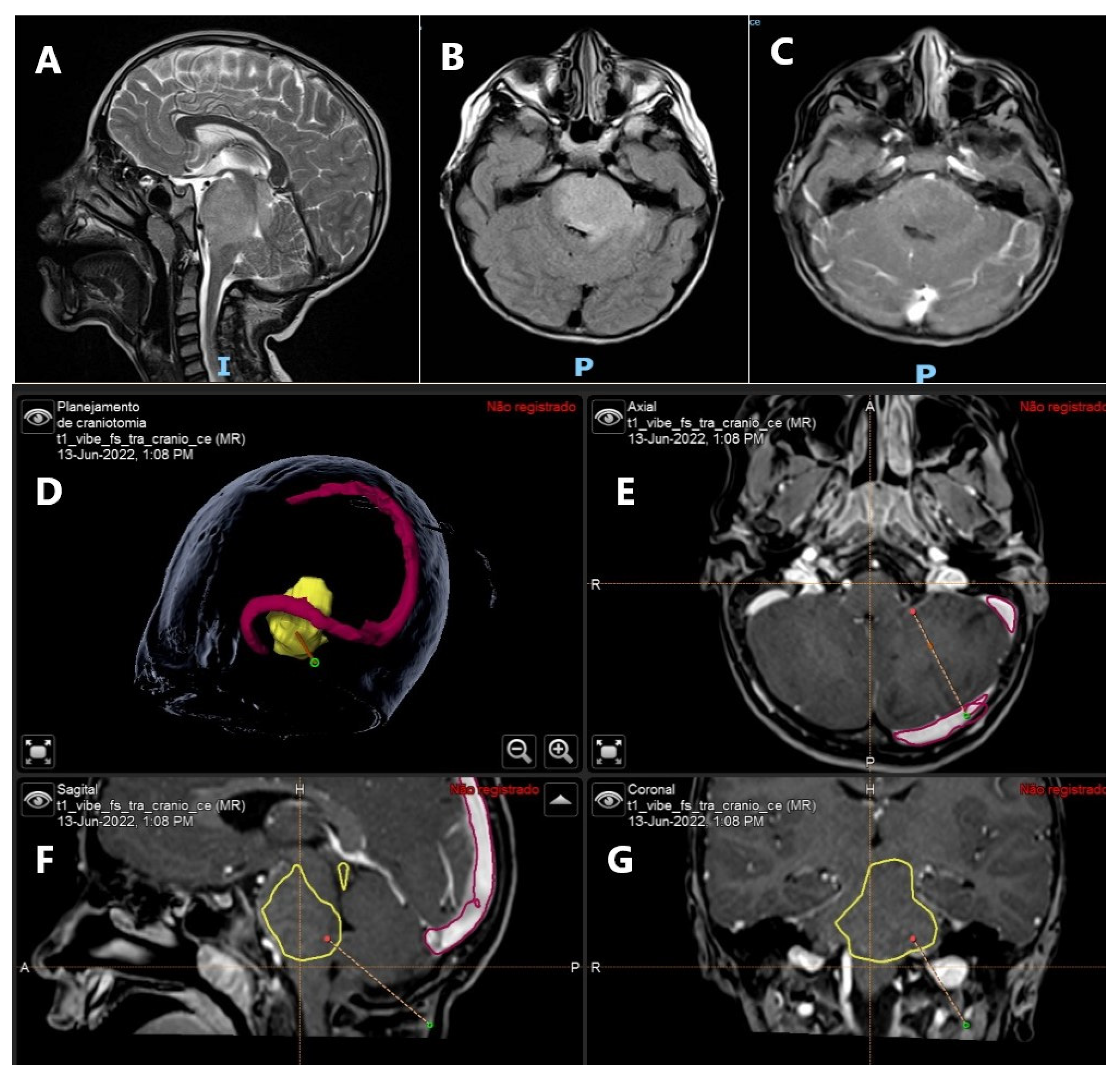 Ijms 23 13430 g002 Ijms 23 13430 g002