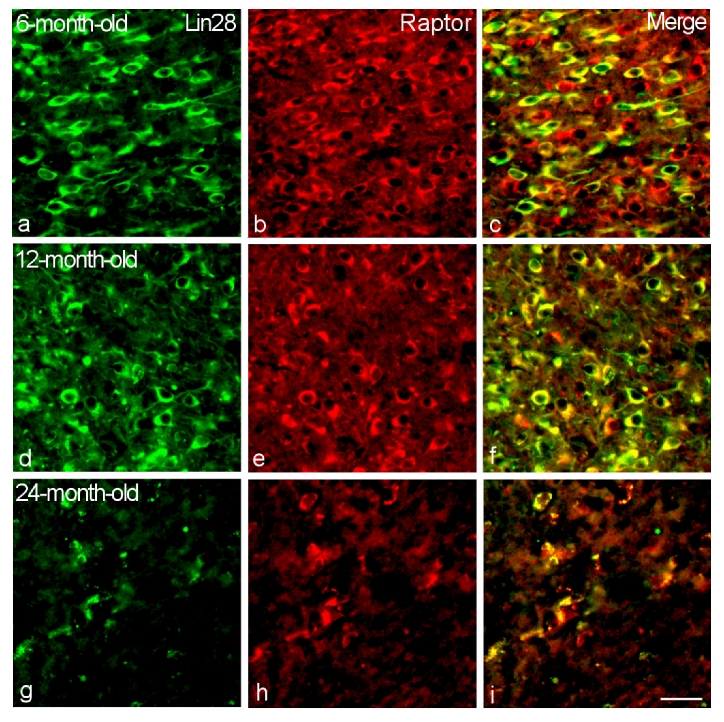 Ijms 23 13468 g007 Ijms 23 13468 g007