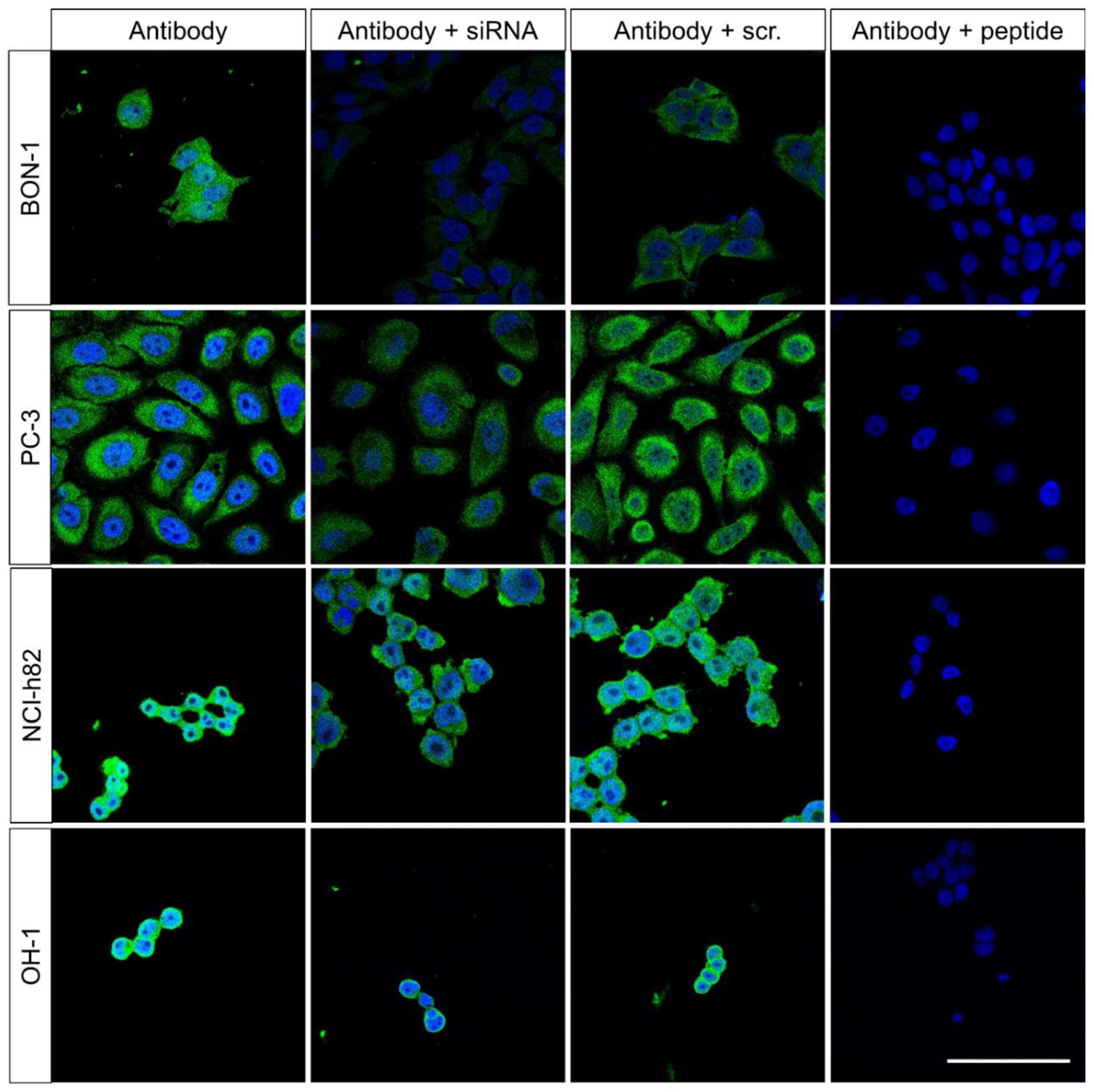 IJMS | Free Full-Text | Co-Expression of Adaptor Protein FAM159B