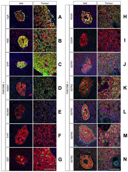 IJMS | Free Full-Text | Co-Expression of Adaptor Protein FAM159B