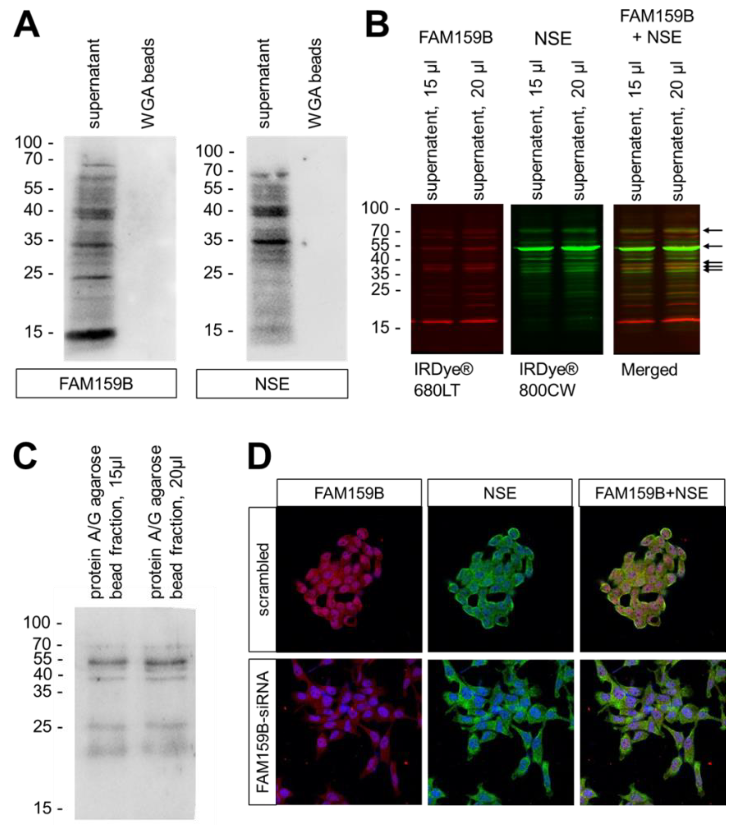 IJMS | Free Full-Text | Co-Expression of Adaptor Protein FAM159B