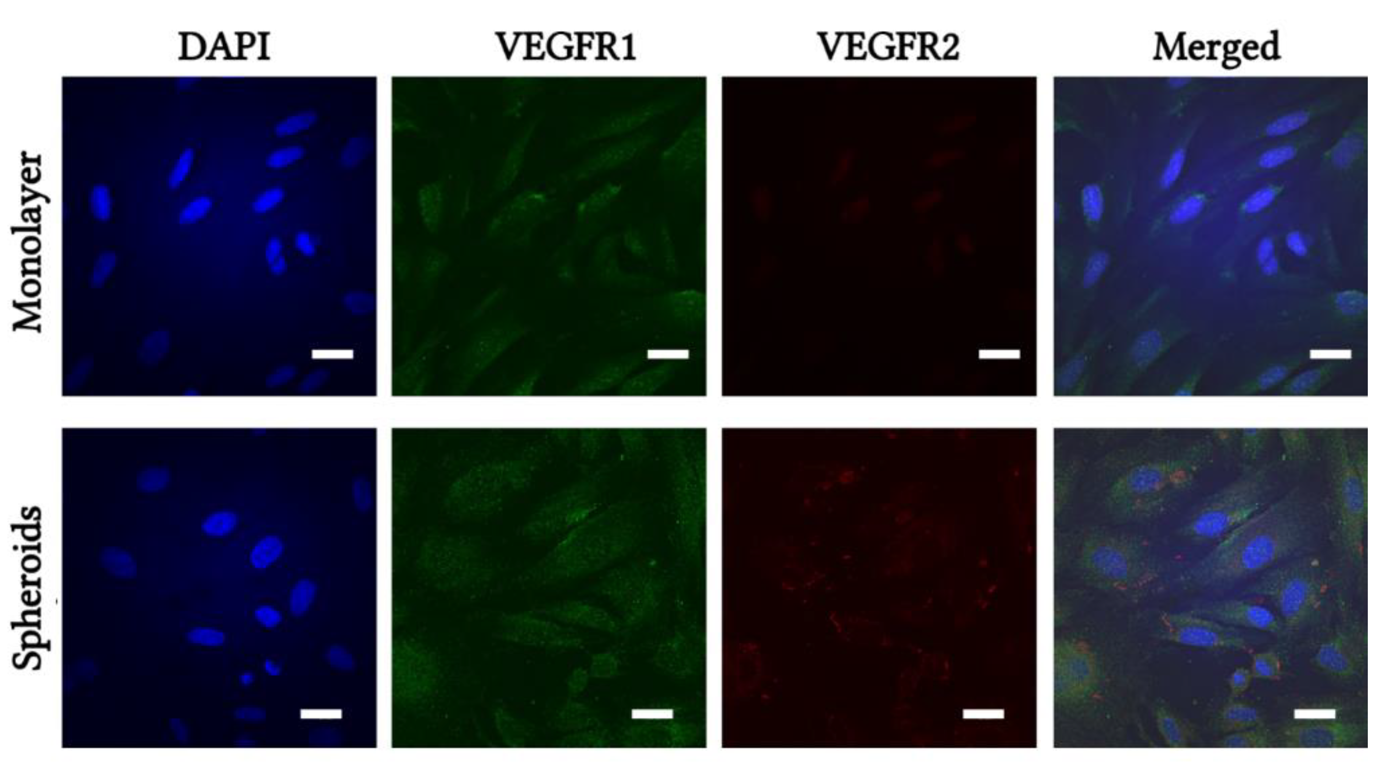 Ijms Free Full Text Paracrine And Autocrine Effects Of Vegf Are