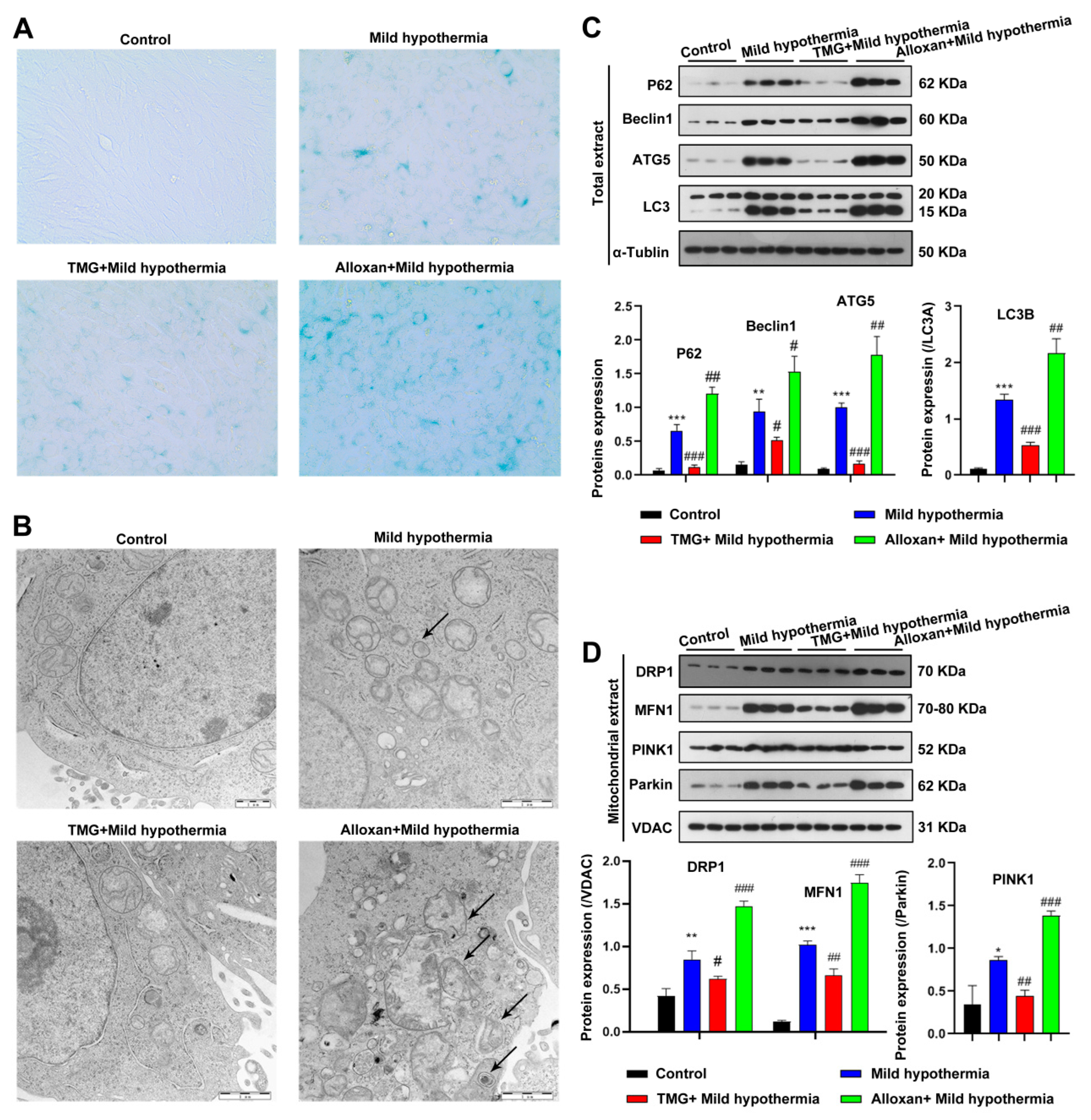 Ijms 23 14520 g004 Ijms 23 14520 g004