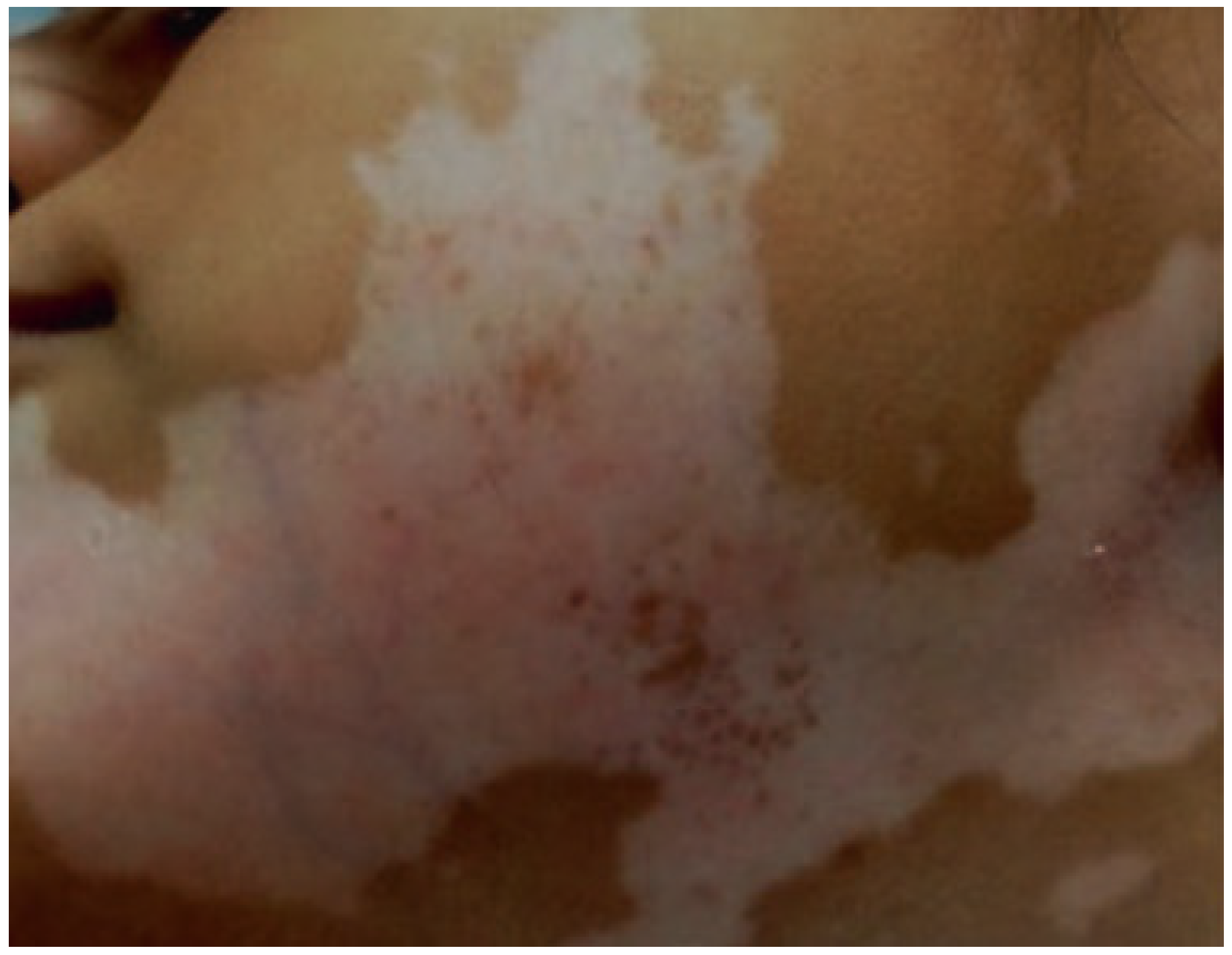 Ijms 23 15222 g024 Ijms 23 15222 g024