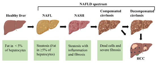 IJMS | Free Full-Text | Non-Alcoholic Fatty Liver Disease (NAFLD ...