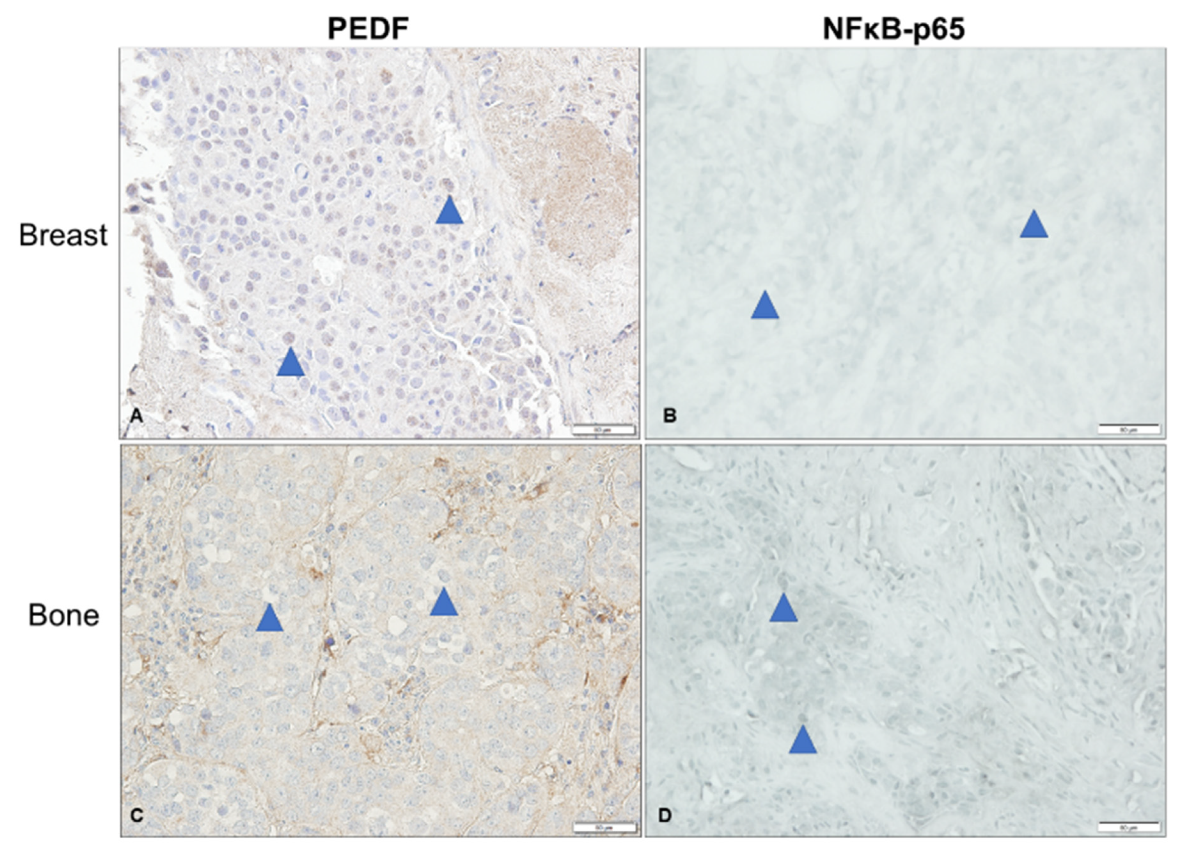 Ijms 23 15641 g005 Ijms 23 15641 g005