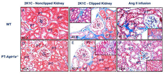 Ijms Free Full Text Genetic Deletion Of At1a Receptor Or Na H