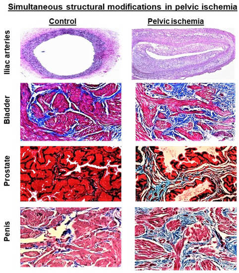 IJMS Free Full Text Molecular Regulation of Concomitant Lower