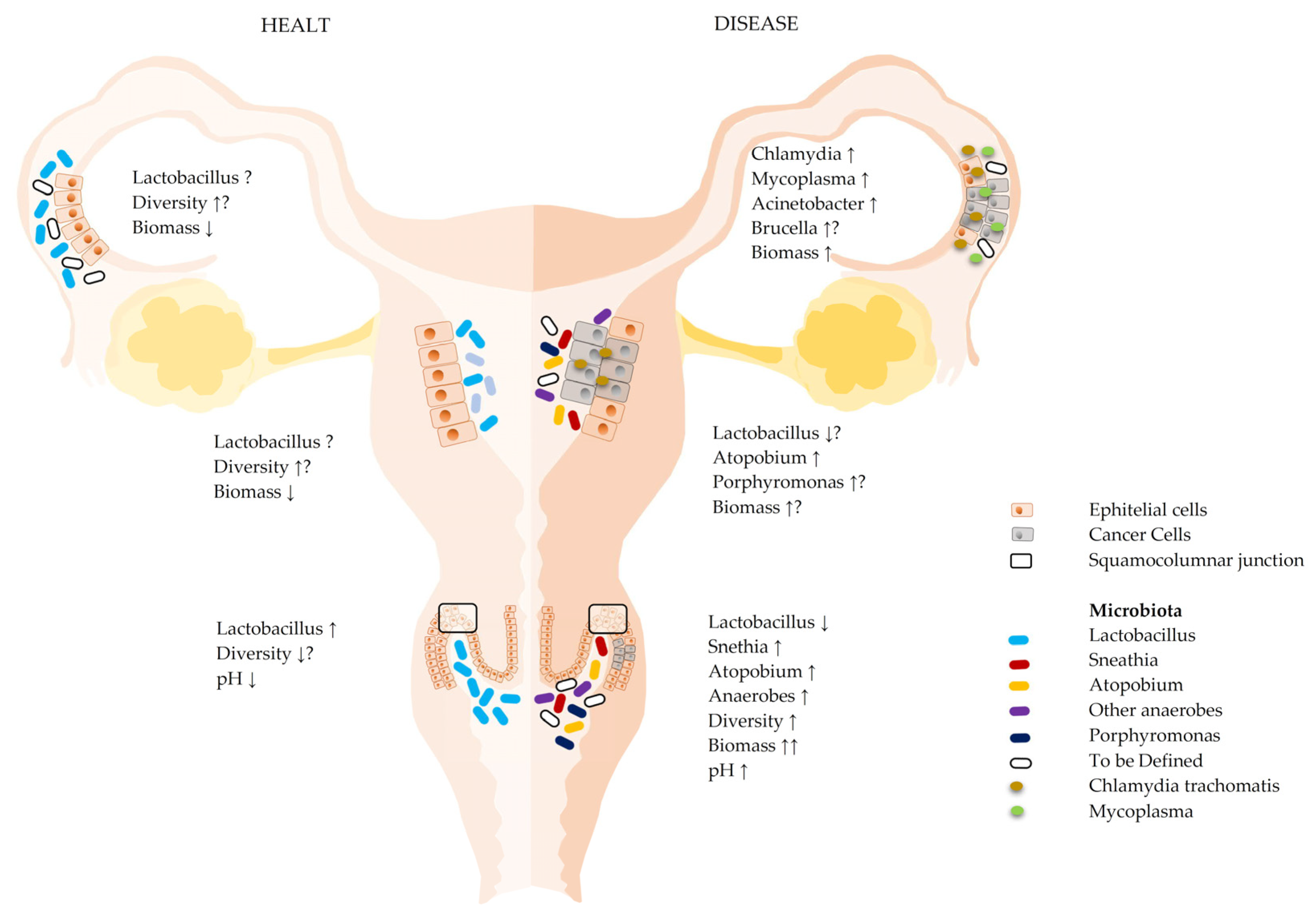 IJMS | Free Full-Text | Ovarian Microbiota, Ovarian Cancer and the  Underestimated Role of HPV