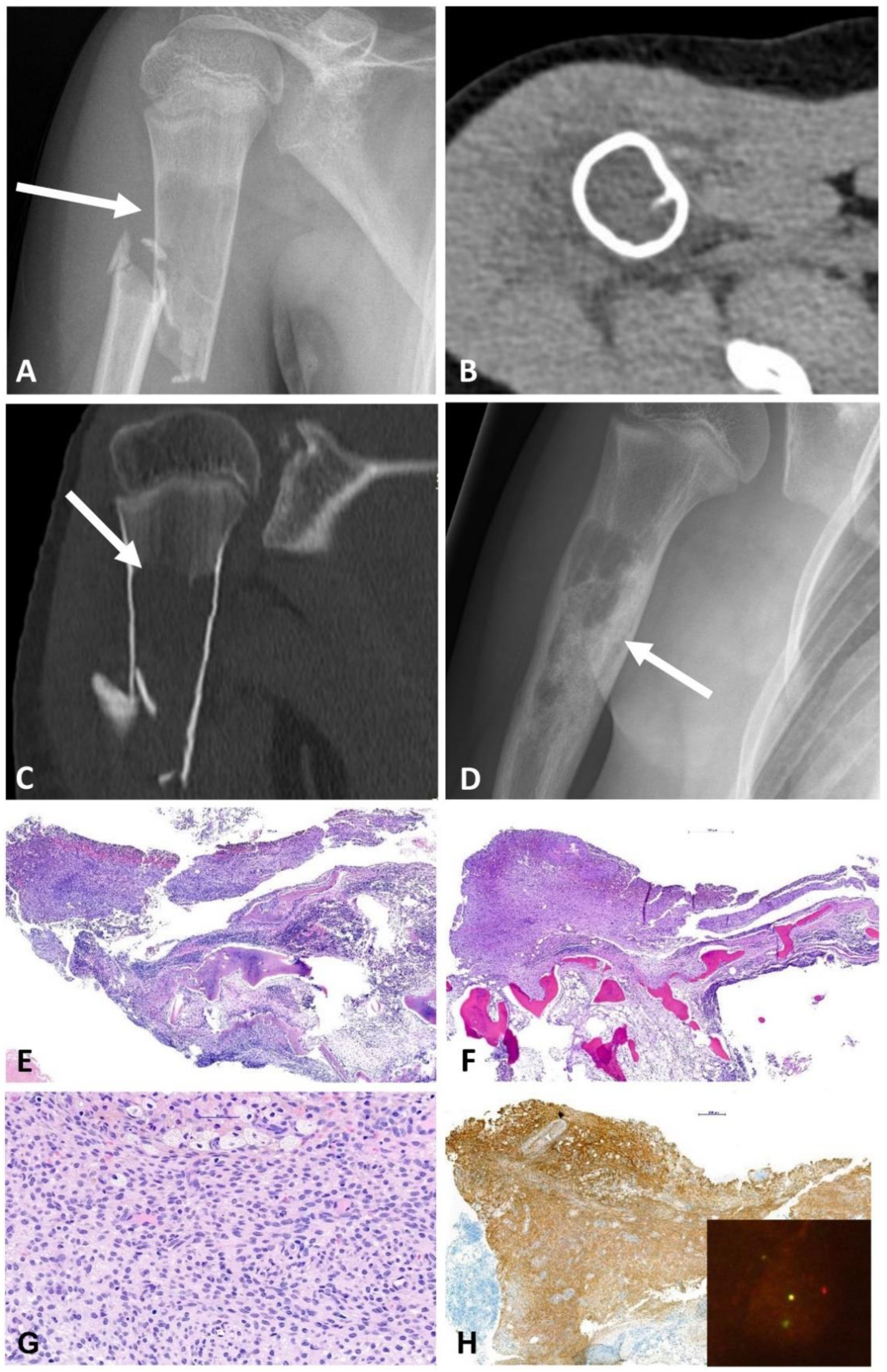 Ijms 23 16196 g005 Ijms 23 16196 g005