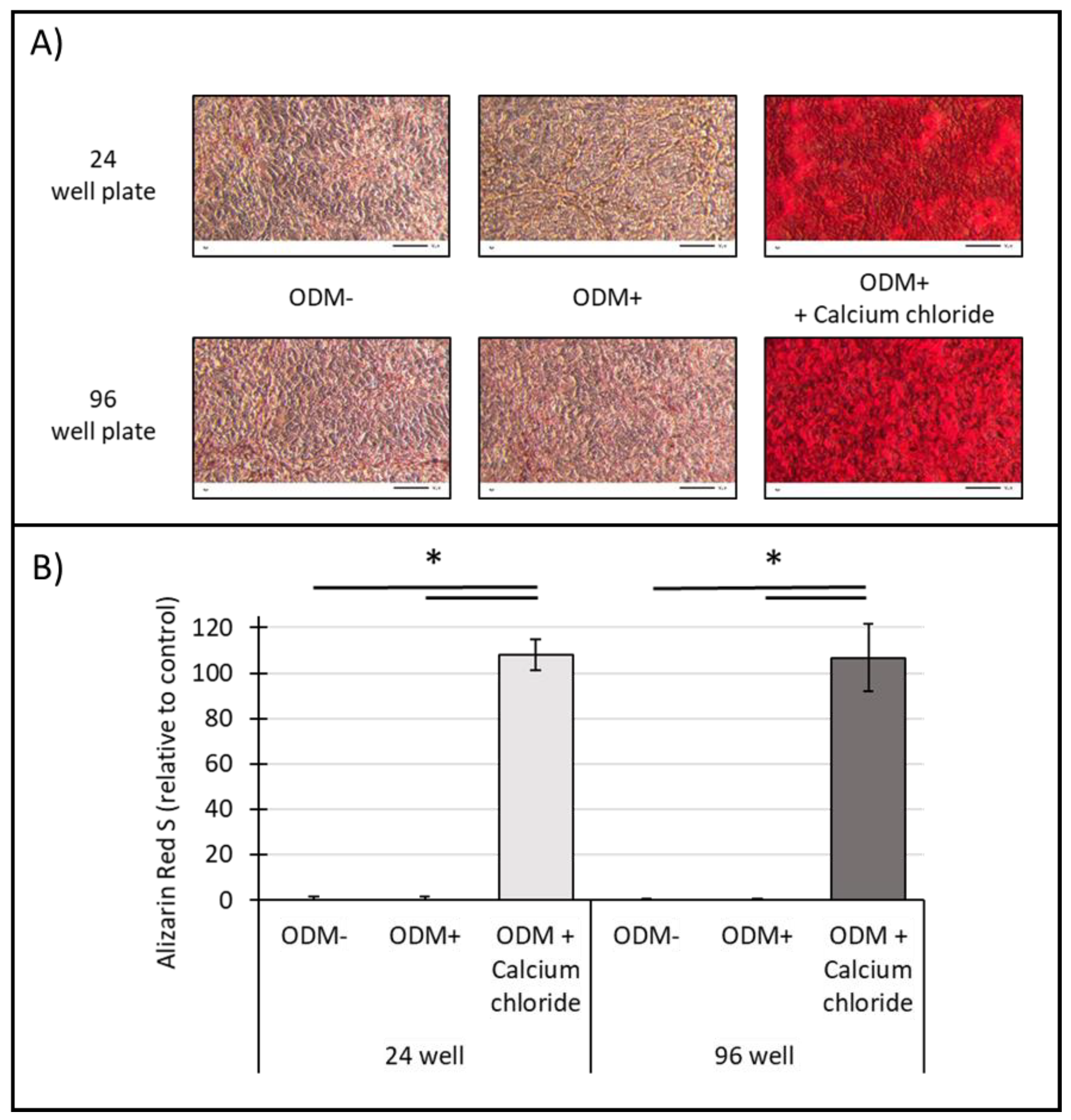 IJMS | Free Full-Text | Optimization of the Alizarin Red S Assay by  Enhancing Mineralization of Osteoblasts