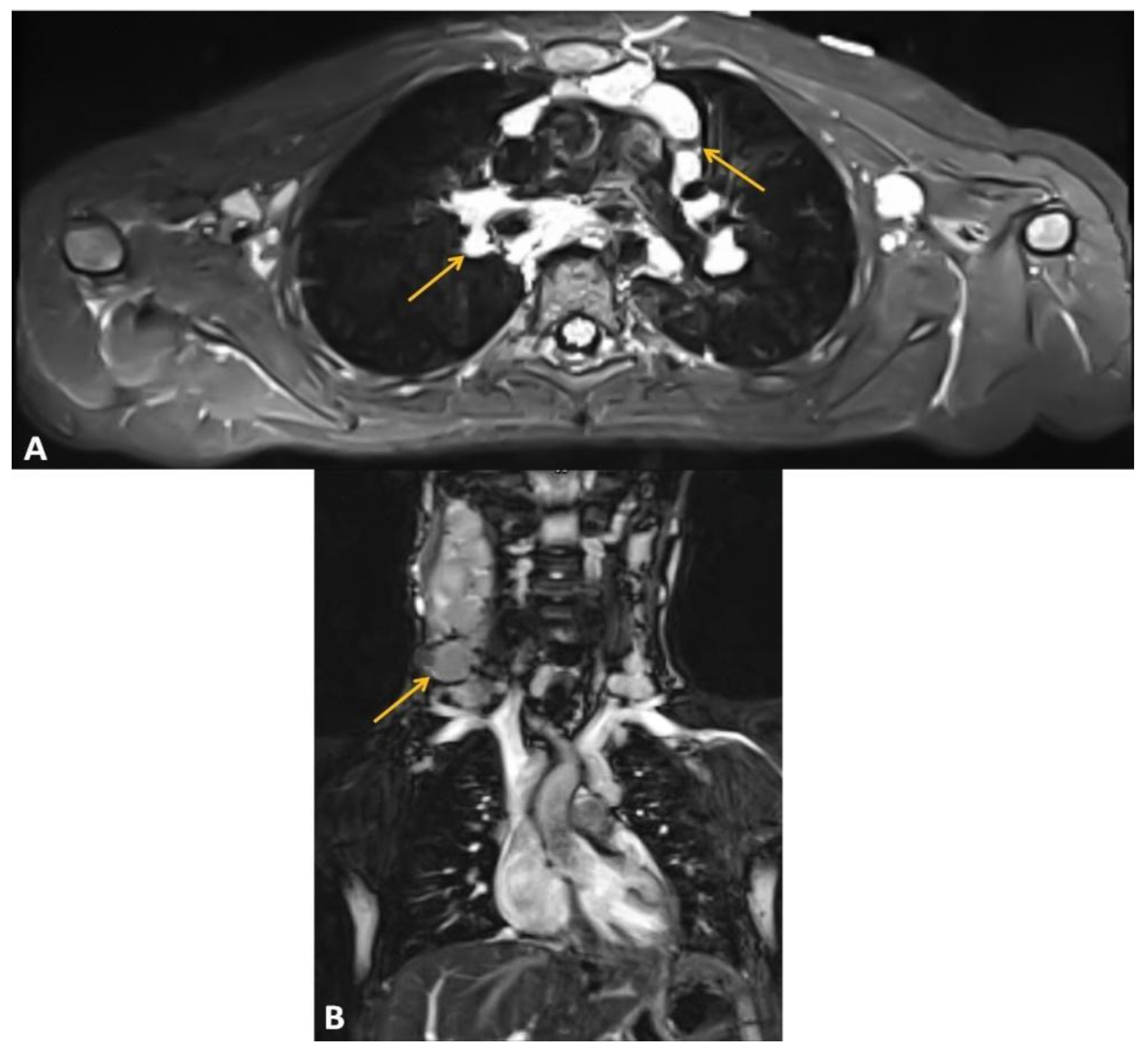 Ijms 24 01099 g002 Ijms 24 01099 g002