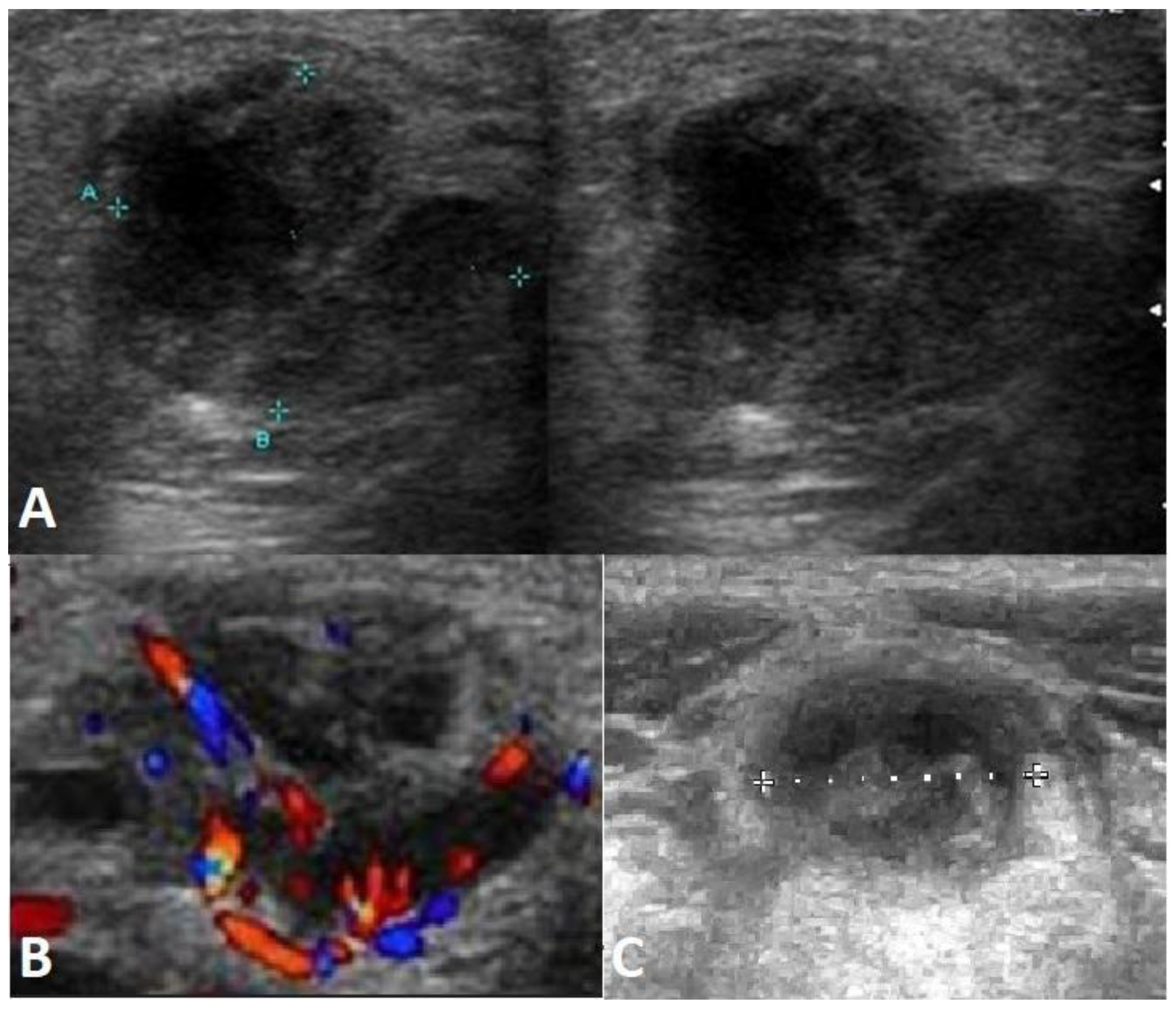 Ijms 24 01099 g003 Ijms 24 01099 g003