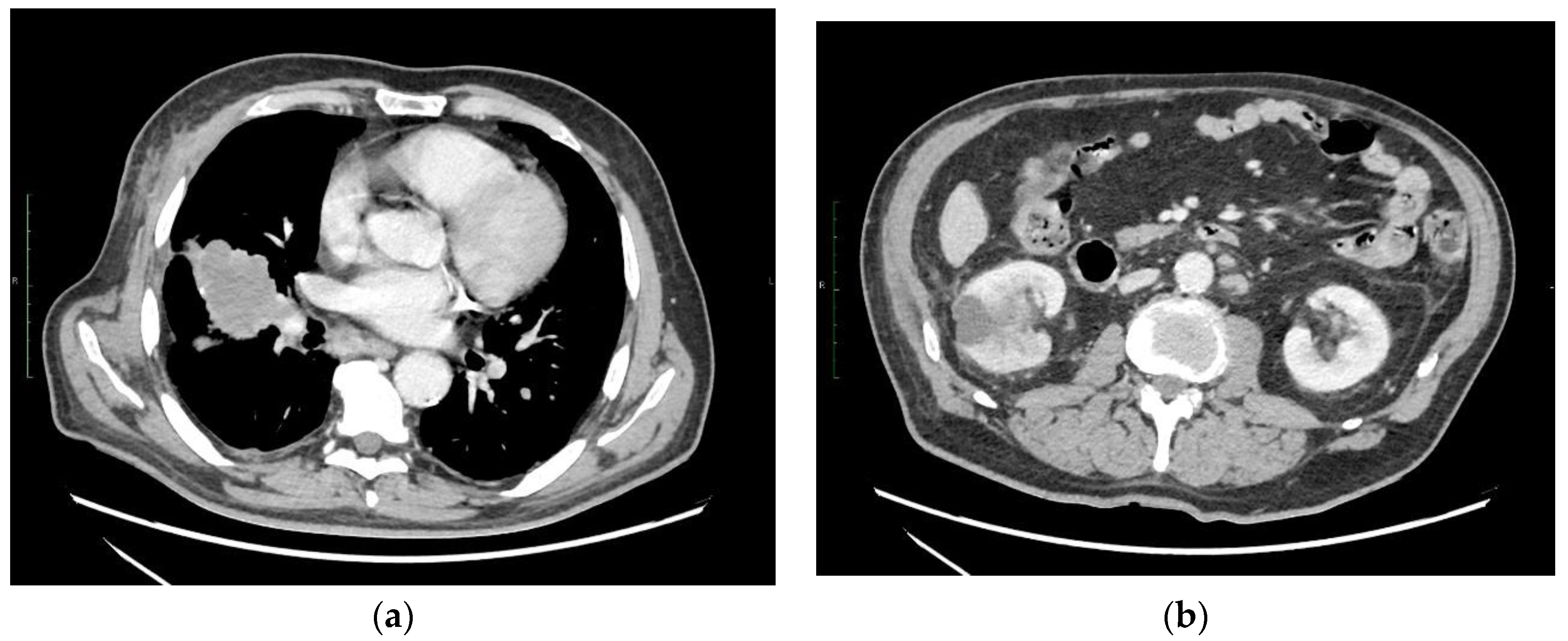 Ijms 24 01195 sch001 Ijms 24 01195 sch001