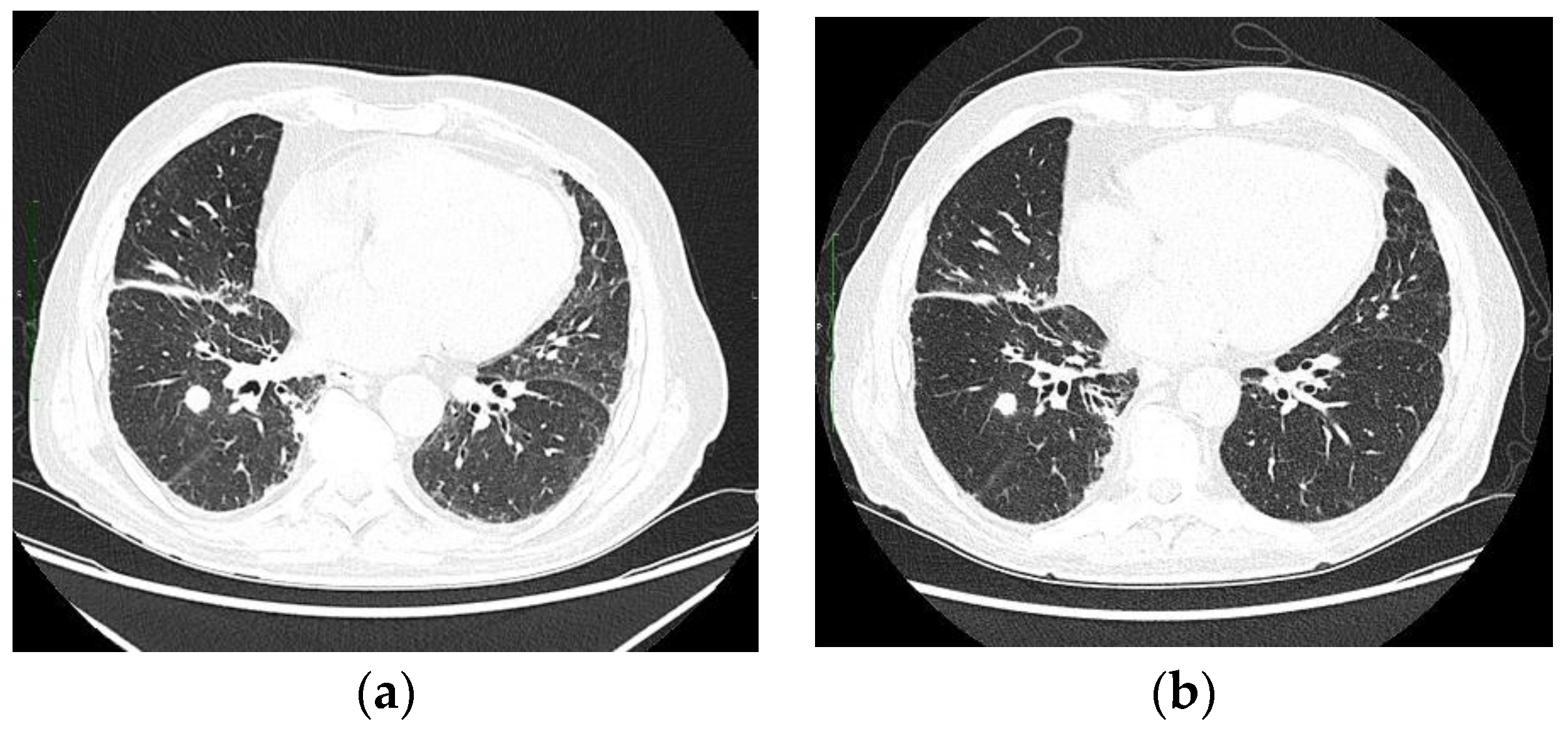 Ijms 24 01195 sch002 Ijms 24 01195 sch002