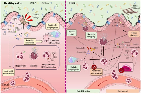Pathophysiology of Crohn's disease inflammation and recurrence, Biology  Direct