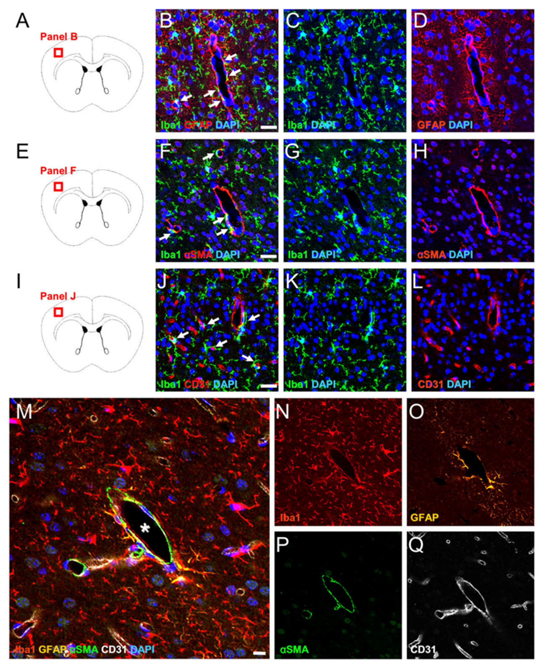 IJMS | Free Full-Text | Different Contacted Cell Types Contribute to  Acquiring Different Properties in Brain Microglial Cells upon Intercellular  Interaction
