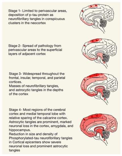 Understanding Trauma: Learning Brain vs Survival Brain