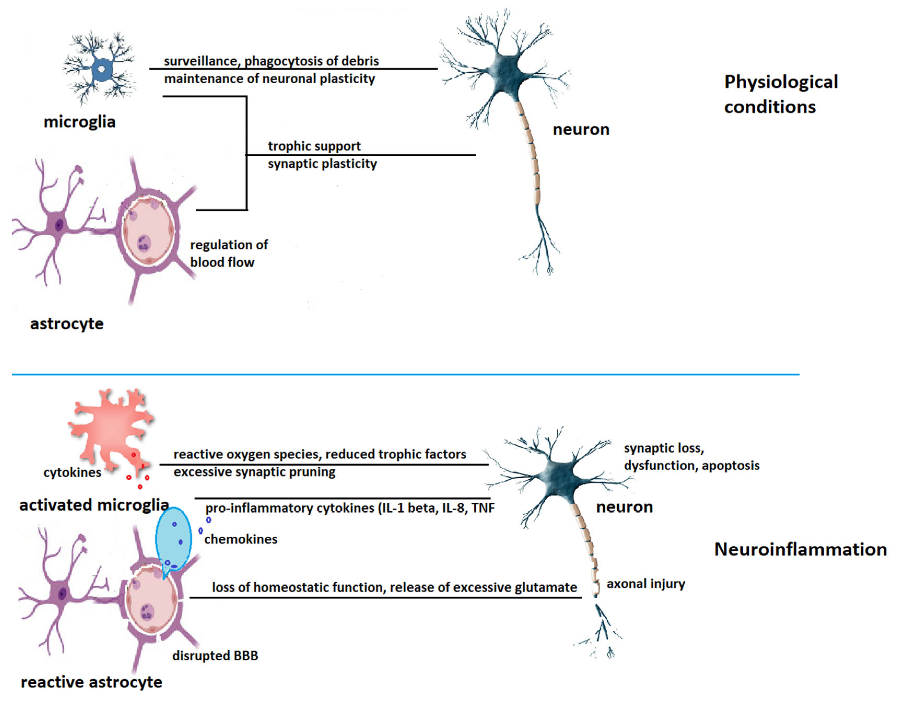 IJMS | Free Full-Text | Molecular Mechanisms of Neuroinflammation in Aging  and Alzheimeru0026rsquo;s Disease Progression