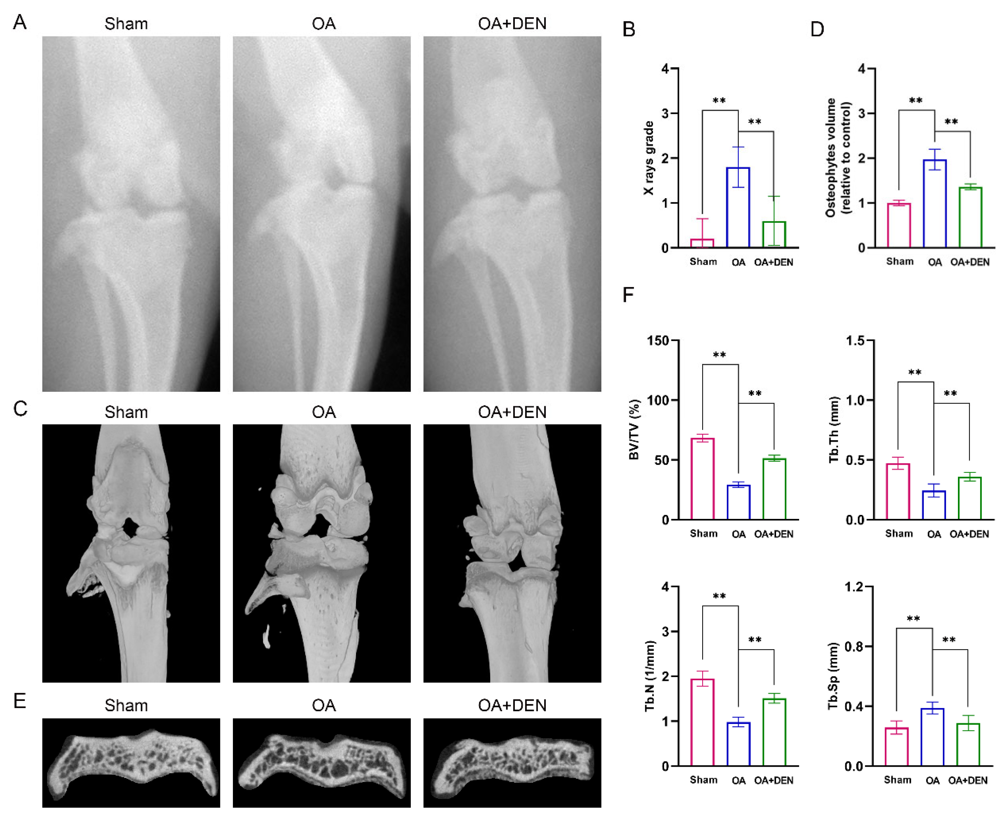 Ijms Free Full Text Dendrobine Alleviates Cellular Senescence And Osteoarthritis Via The Ros 5760