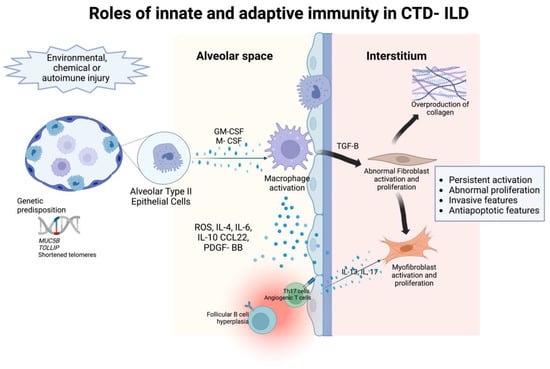 Ijms Free Full Text Understanding Interstitial Lung Diseases Associated With Connective