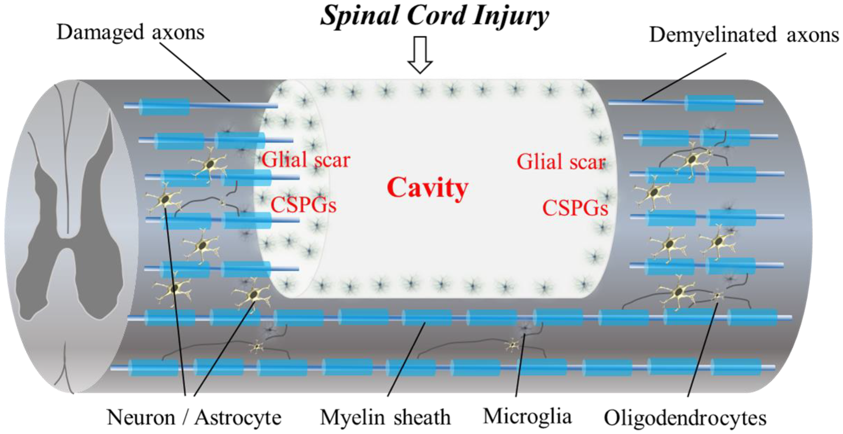IJMS | Free Full-Text | Current Concepts of Biomaterial Scaffolds and  Regenerative Therapy for Spinal Cord Injury