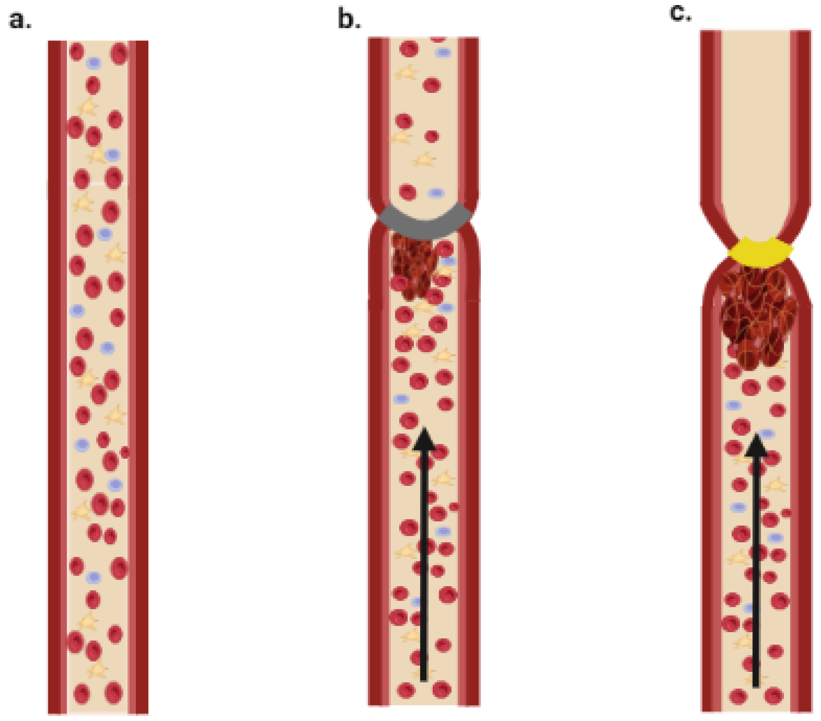 IJMS | Free Full-Text | Thrombosis Models: An Overview Of Common In ...